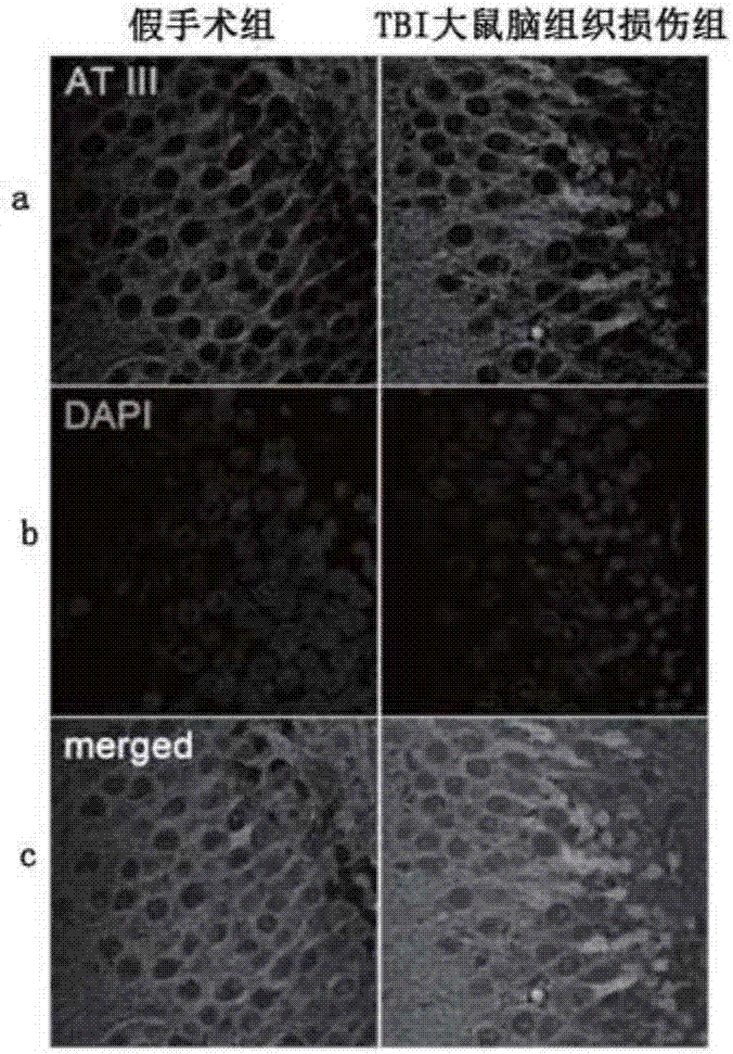 New purpose of antithrombin III and kit