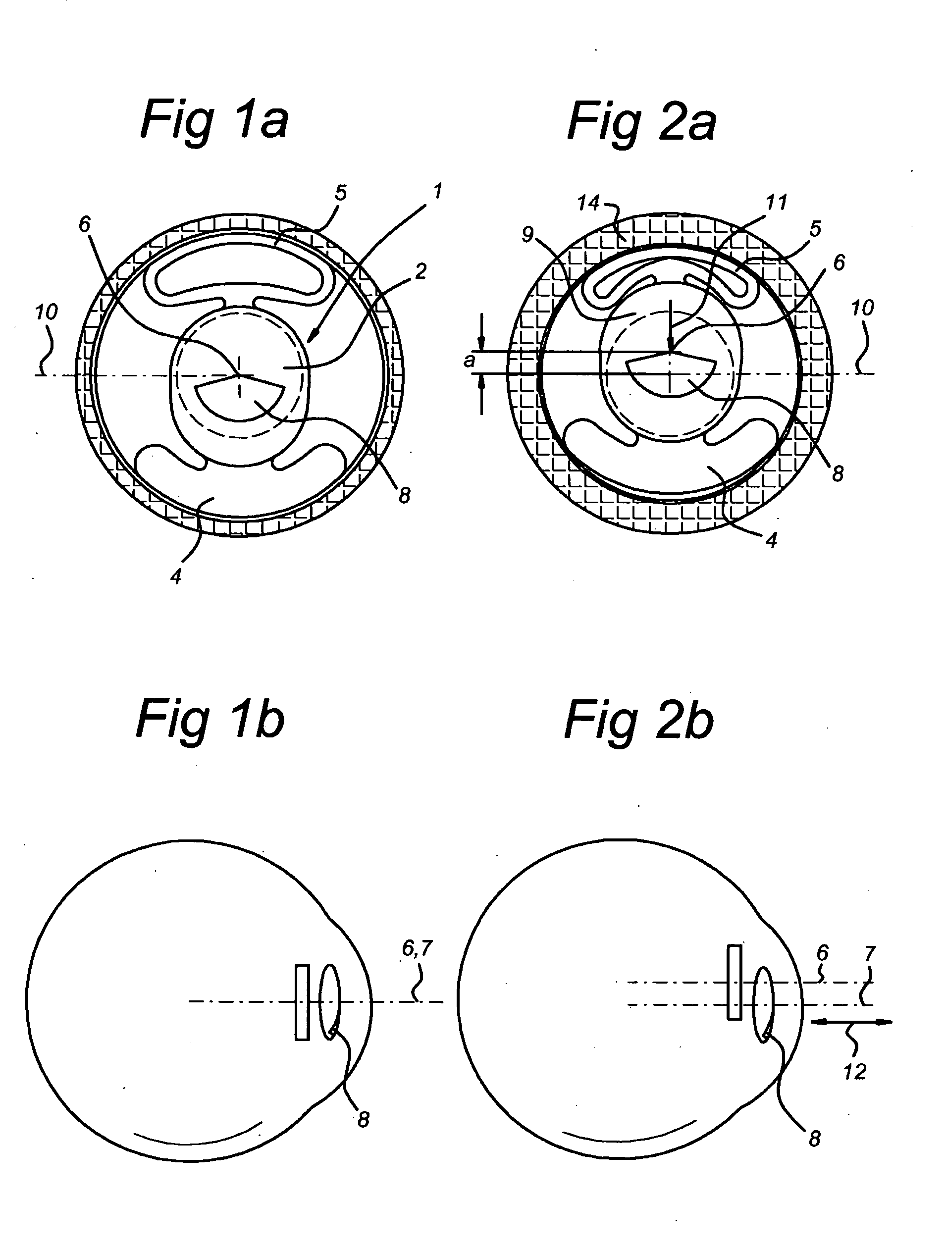 Multifocal Iol