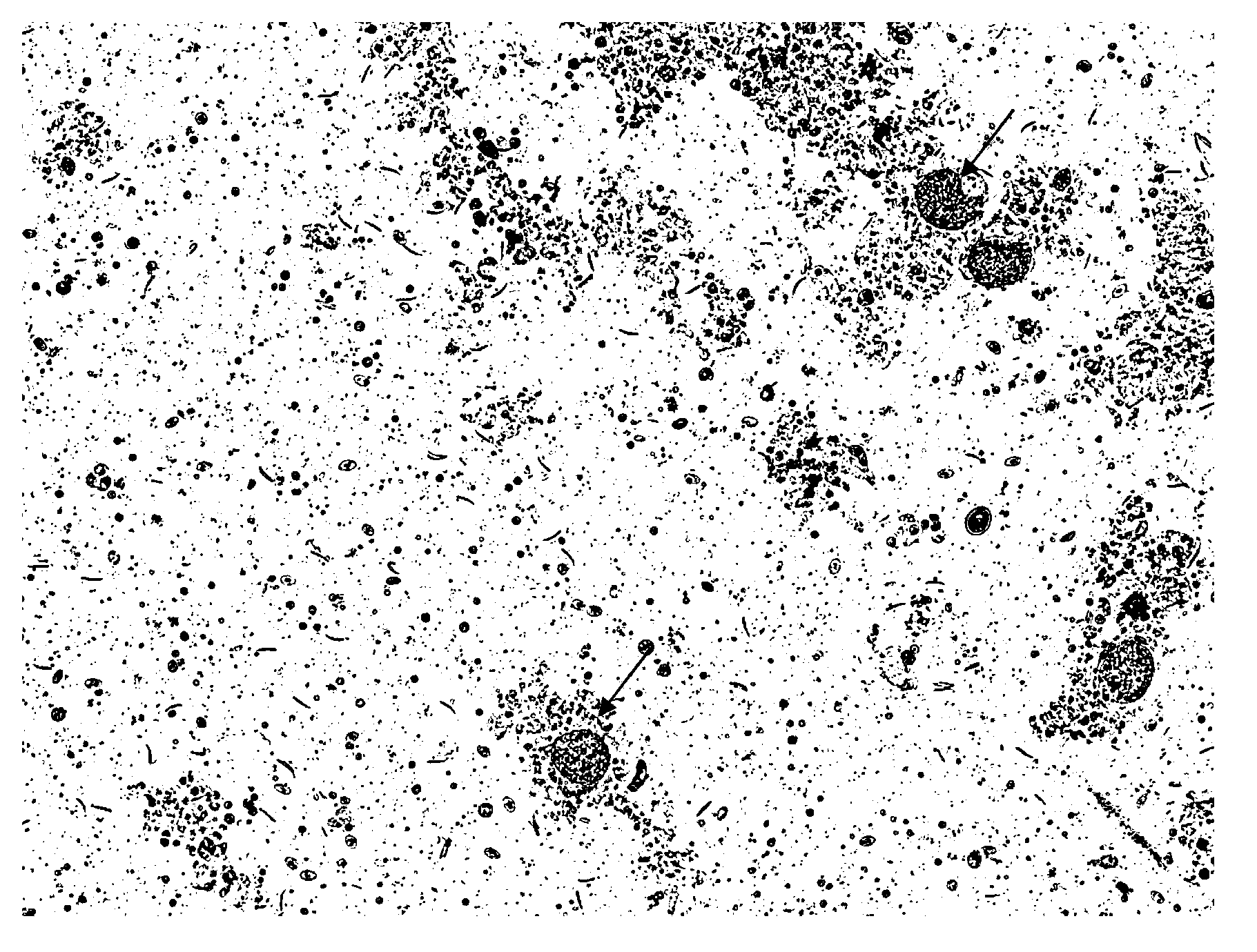 Method for extracting and purifying eimeria tenella merozoite