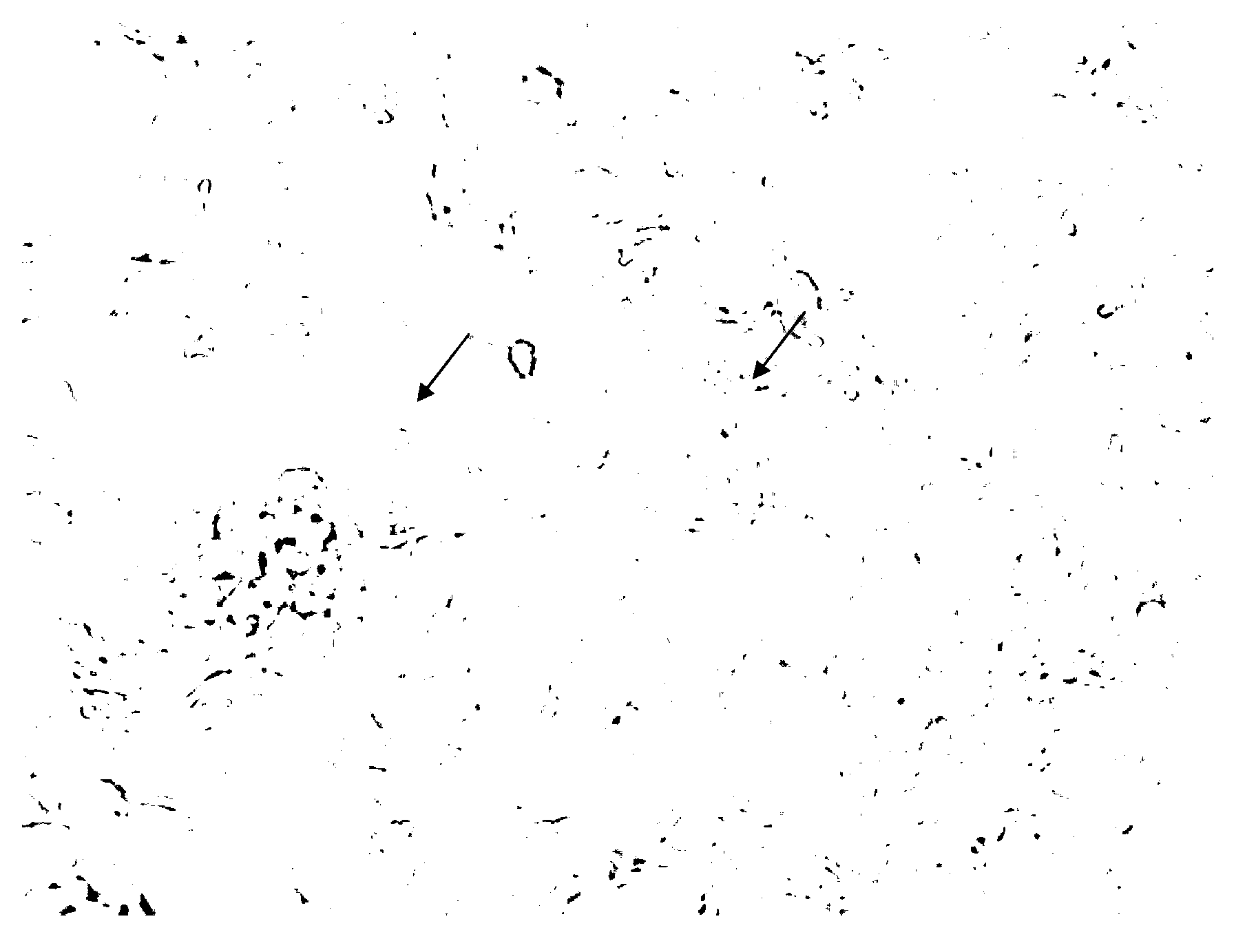 Method for extracting and purifying eimeria tenella merozoite