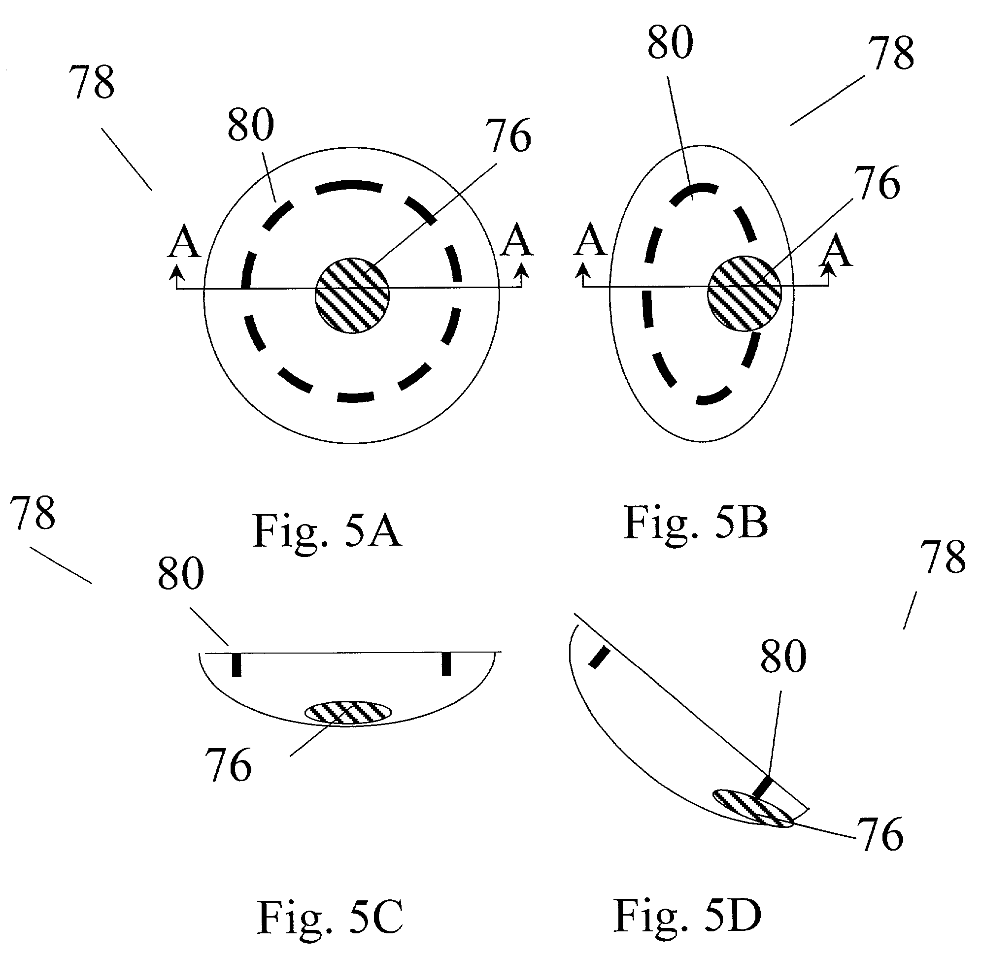 Chair tilt alarm