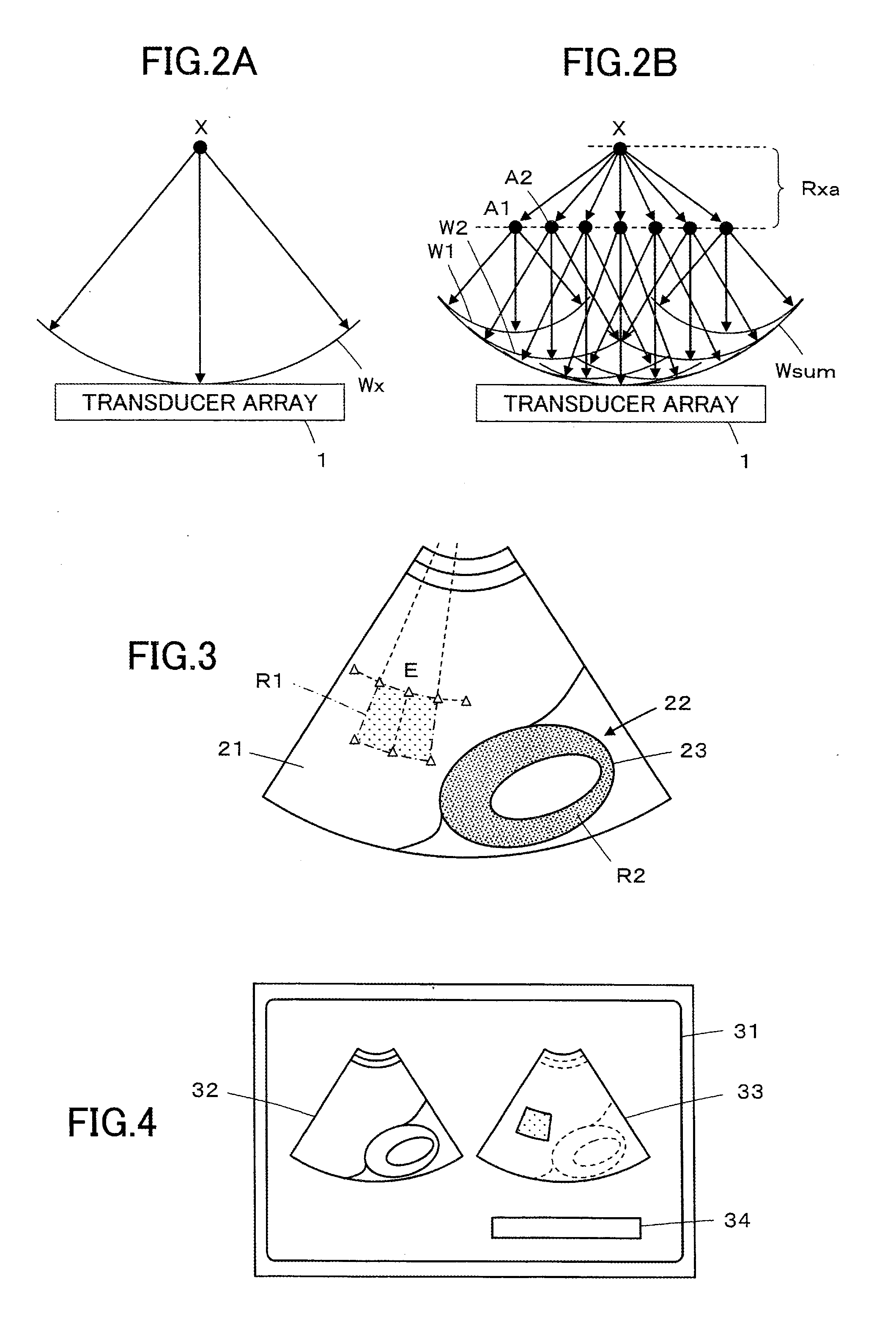 Ultrasound diagnostic apparatus and ultrasound image producing method