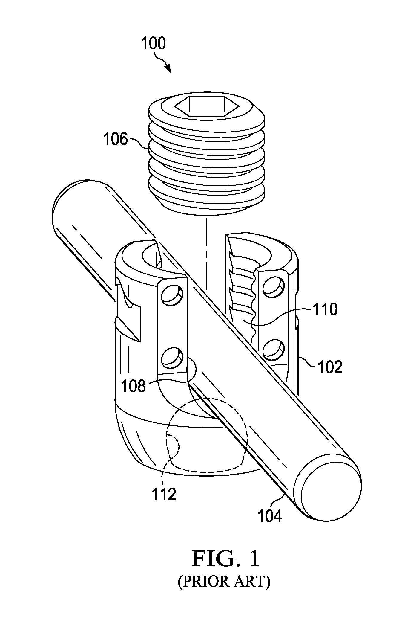 Percutaneous modular head-to-head cross connector