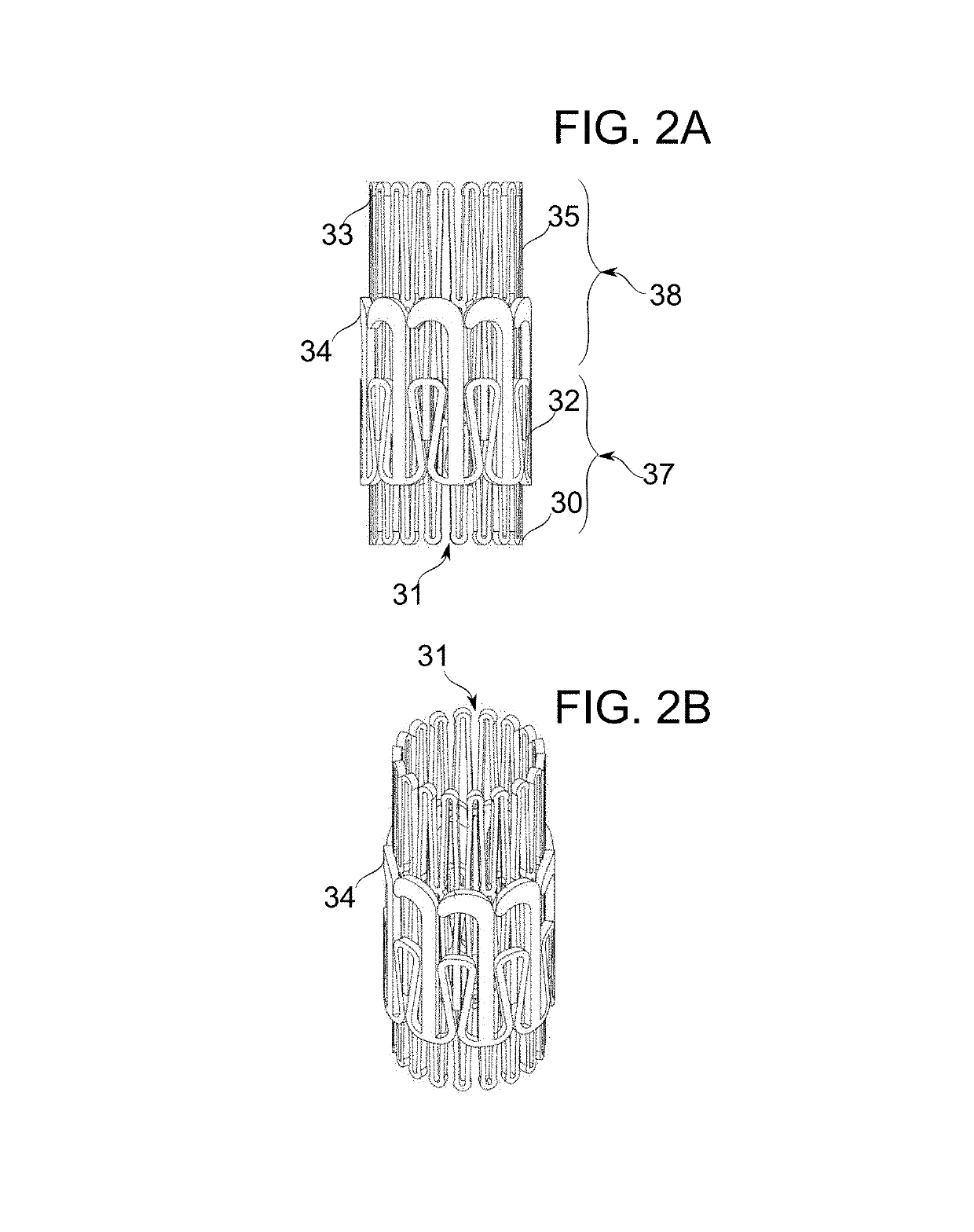 Prosthetic mitral valve