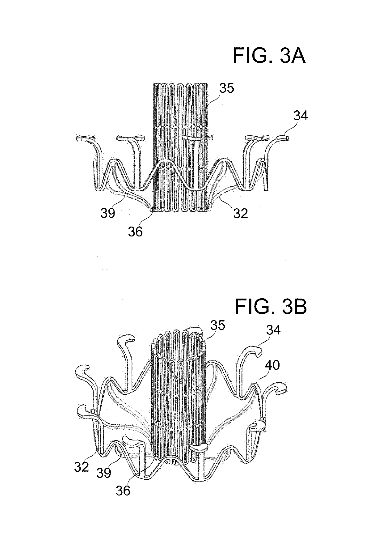 Prosthetic mitral valve