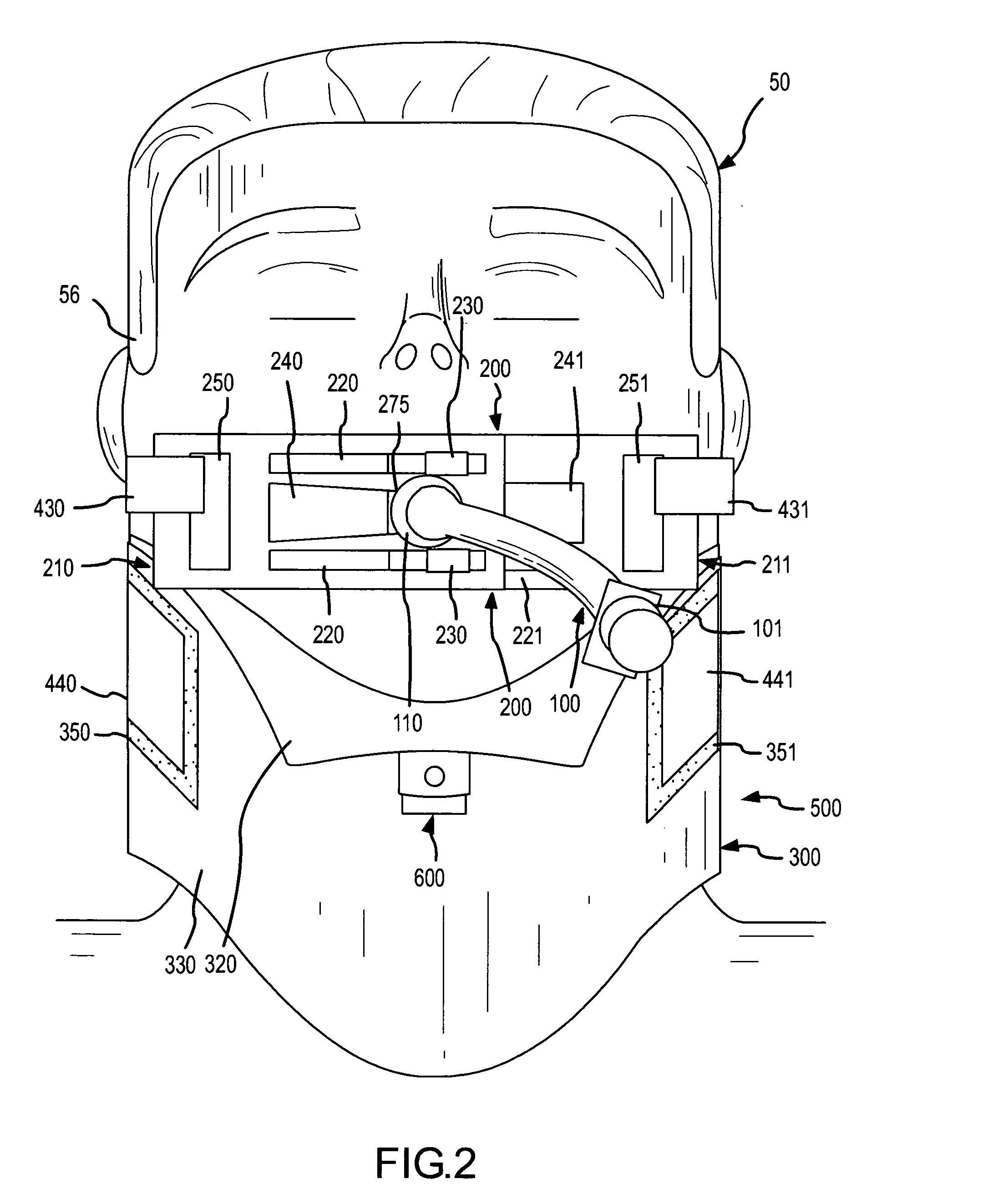 Complete airway stabilization system and method