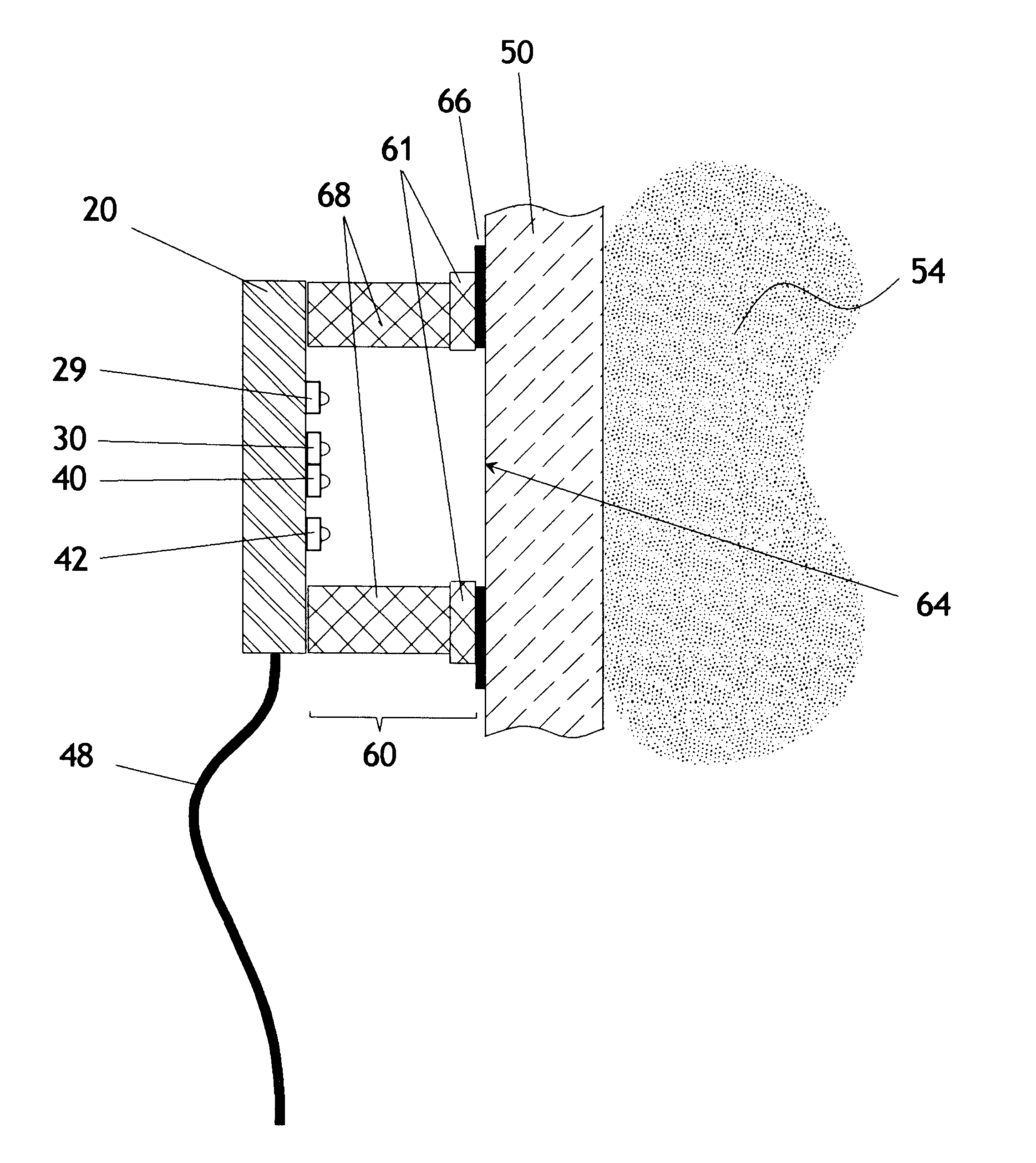 Self-compensating radiation sensor with wide dynamic range