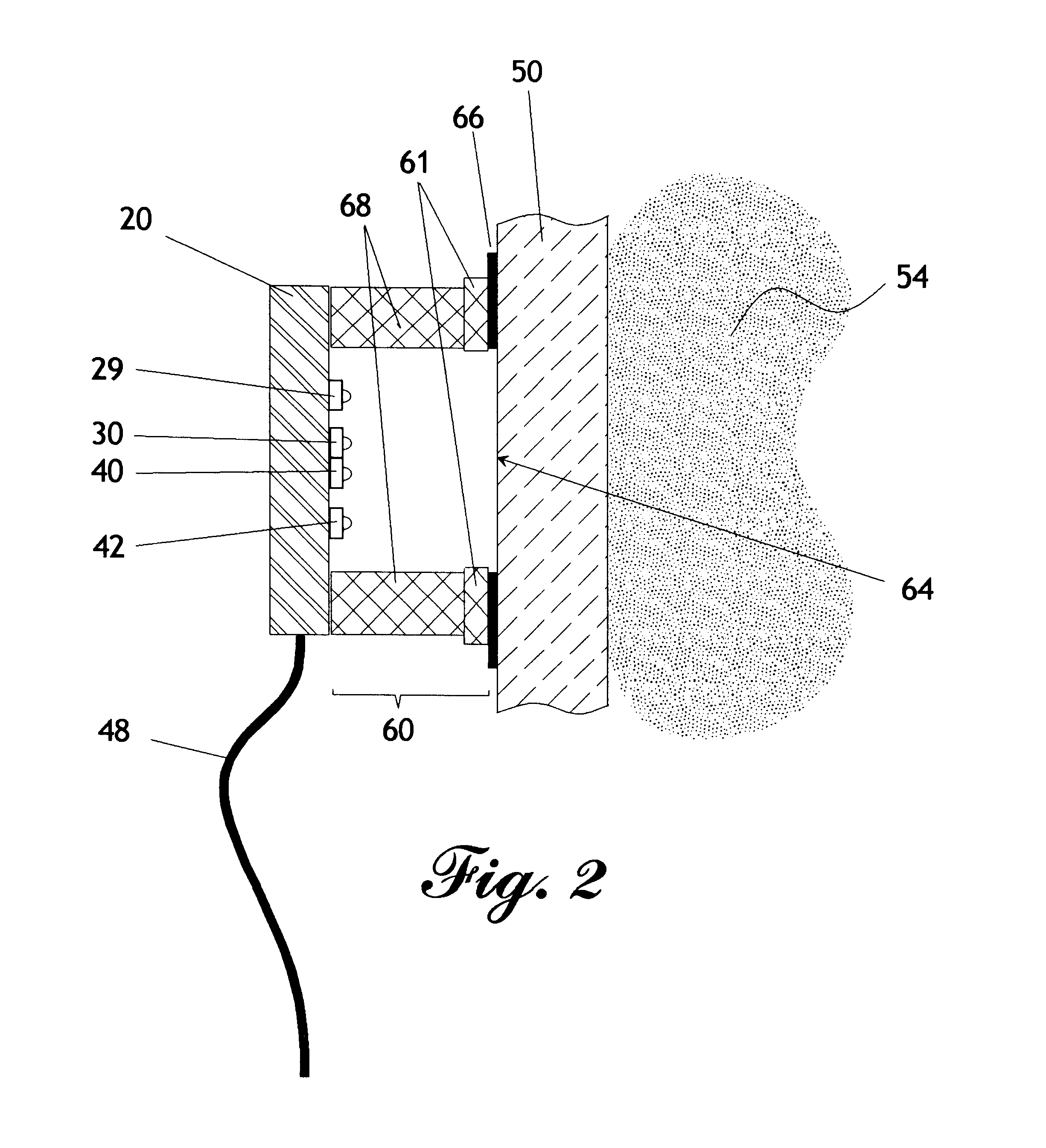 Self-compensating radiation sensor with wide dynamic range