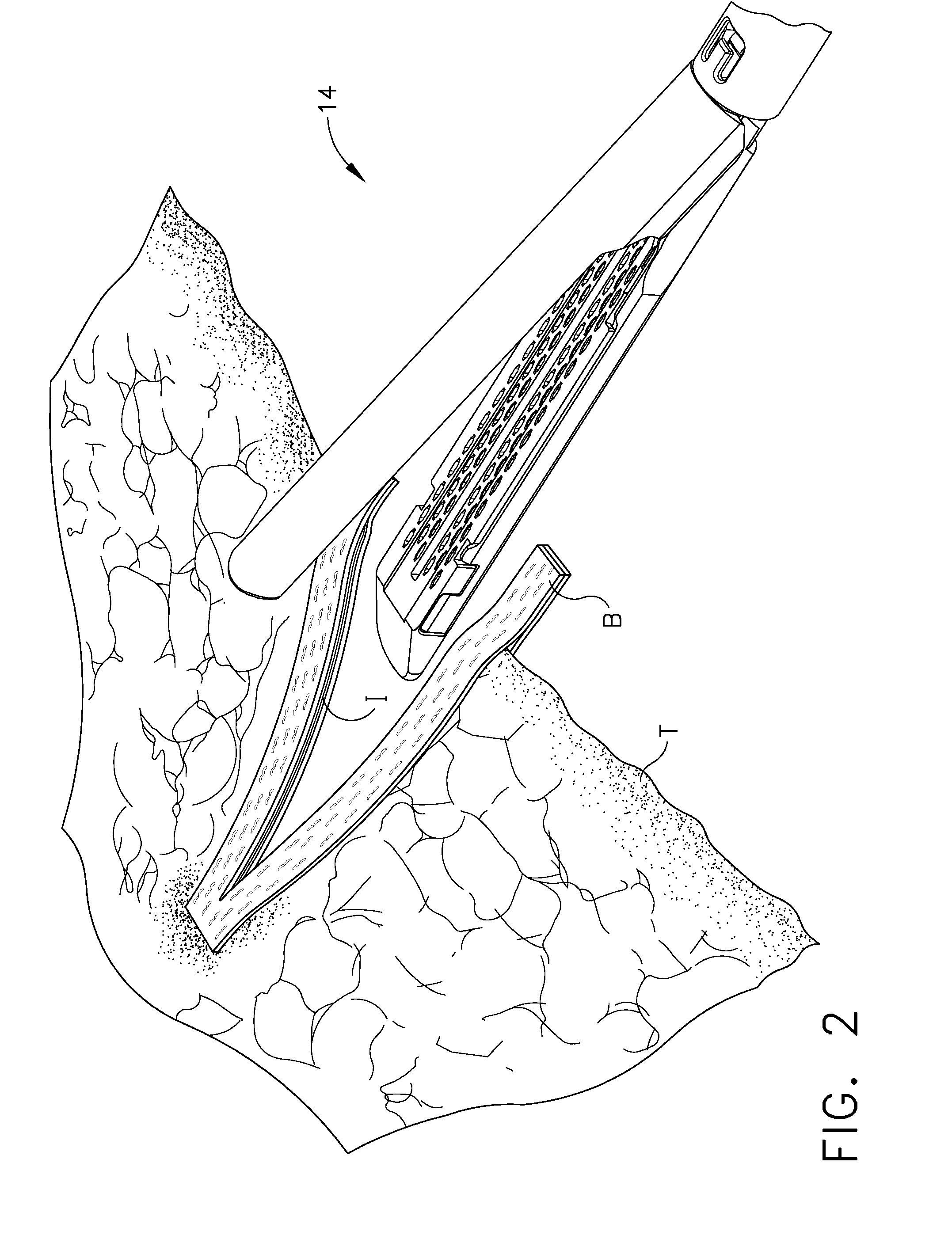 Surgical end effector having buttress retention features