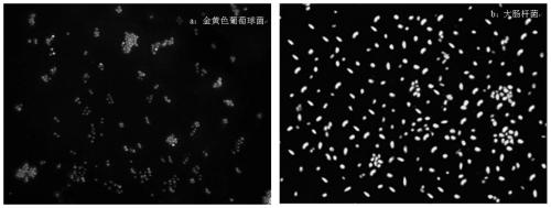 A material with antibacterial synergistic anti-bacterial adhesion function and its preparation and application