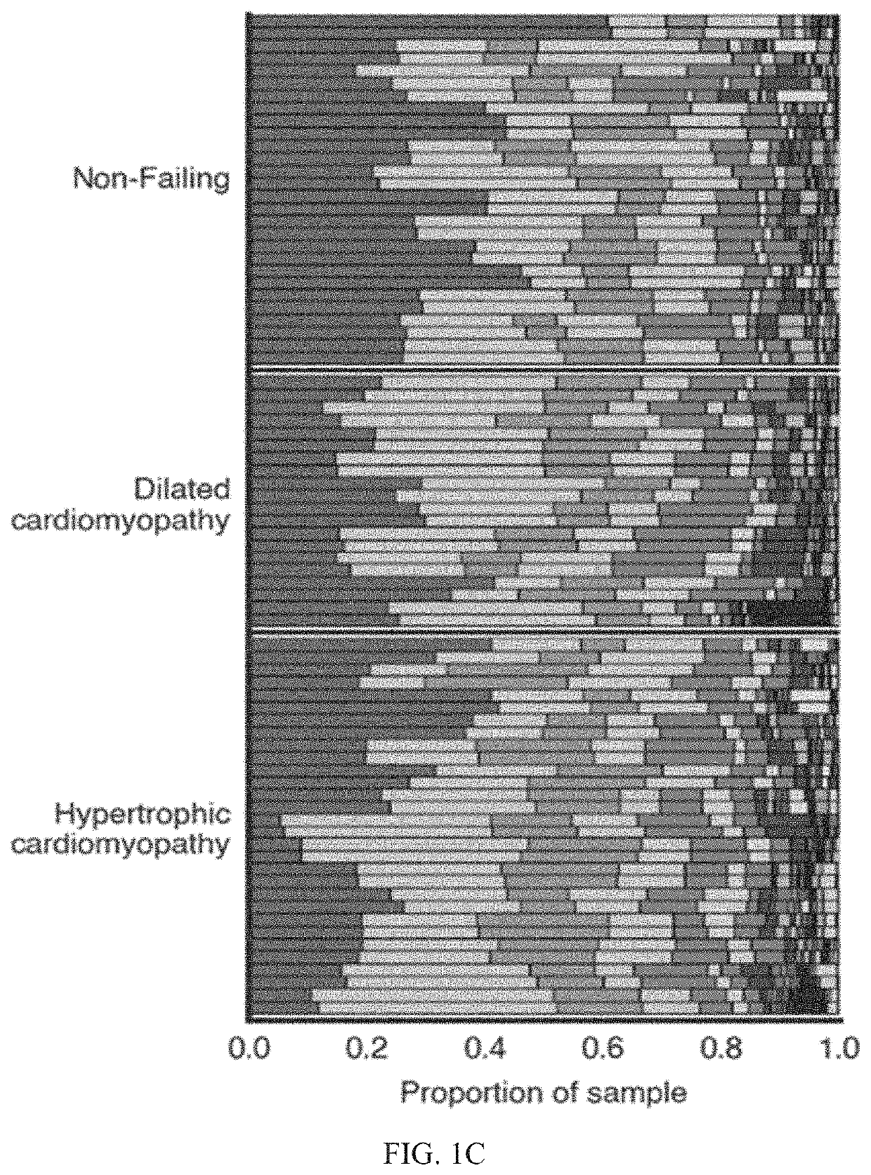 Diagnosis and treatment of cardiomyopathy