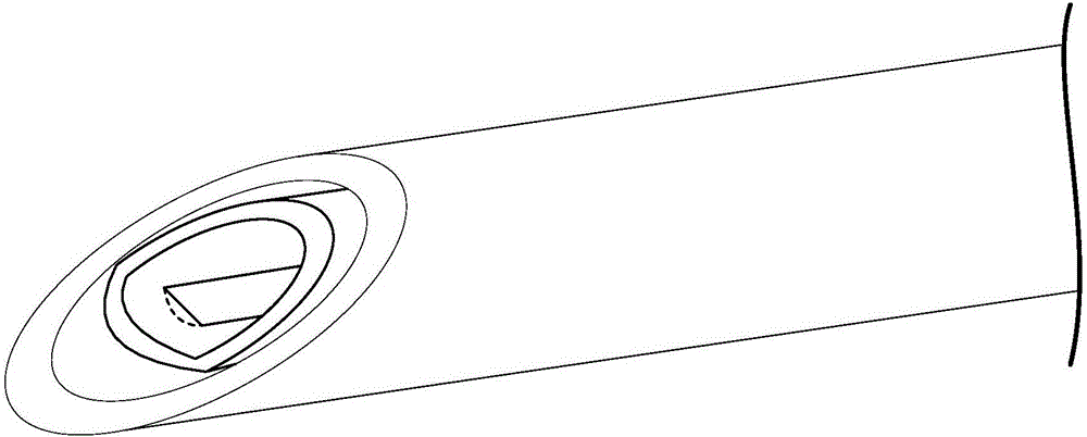 Anterior cruciate ligament attachment avulsion fracture puncturing and fixing thread guider