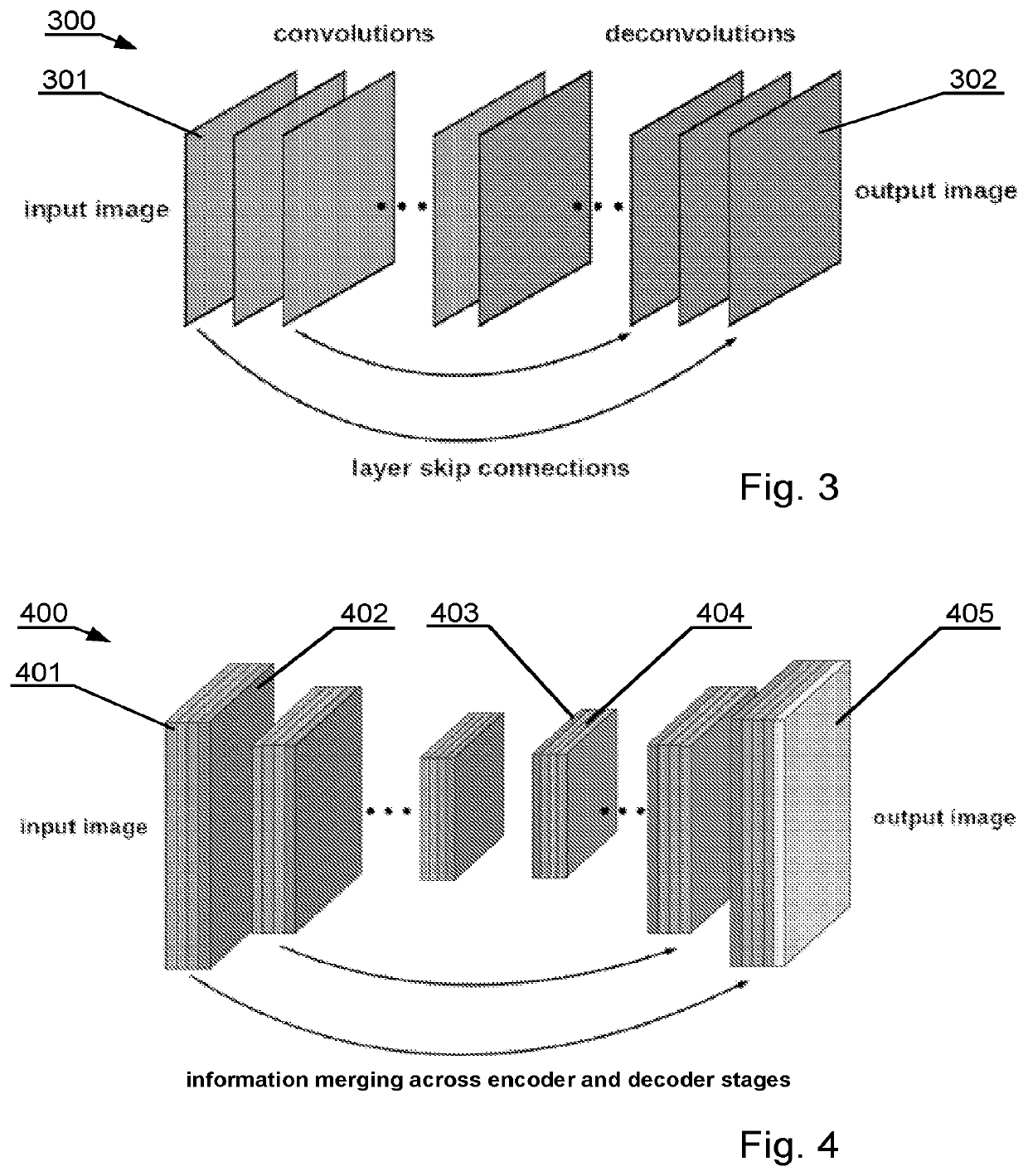 Automated segmentation of three dimensional bony structure images