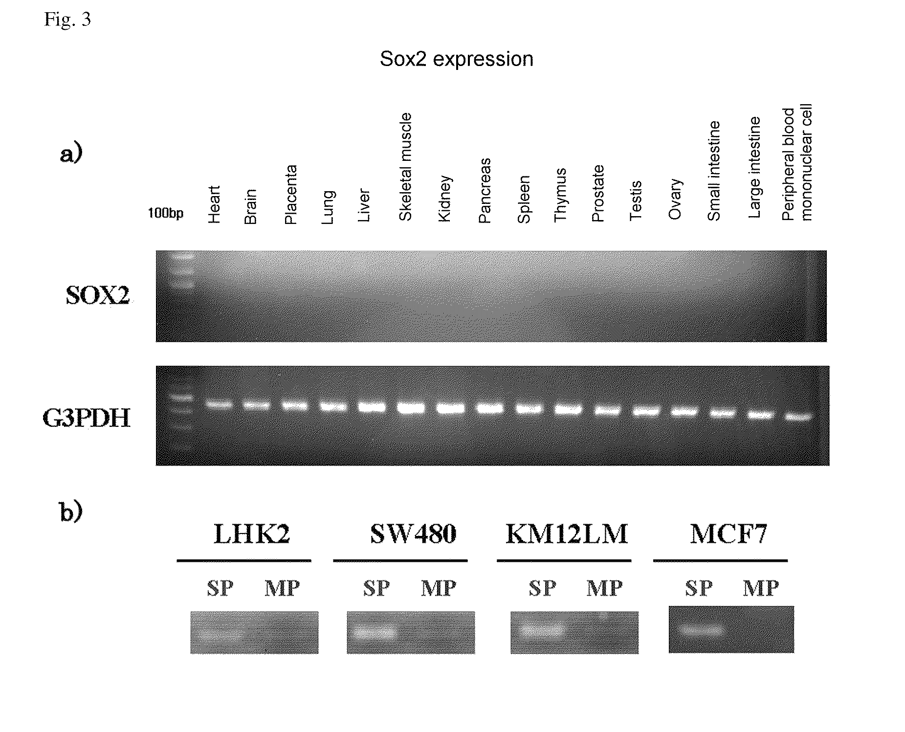 Molecular marker for cancer stem cell