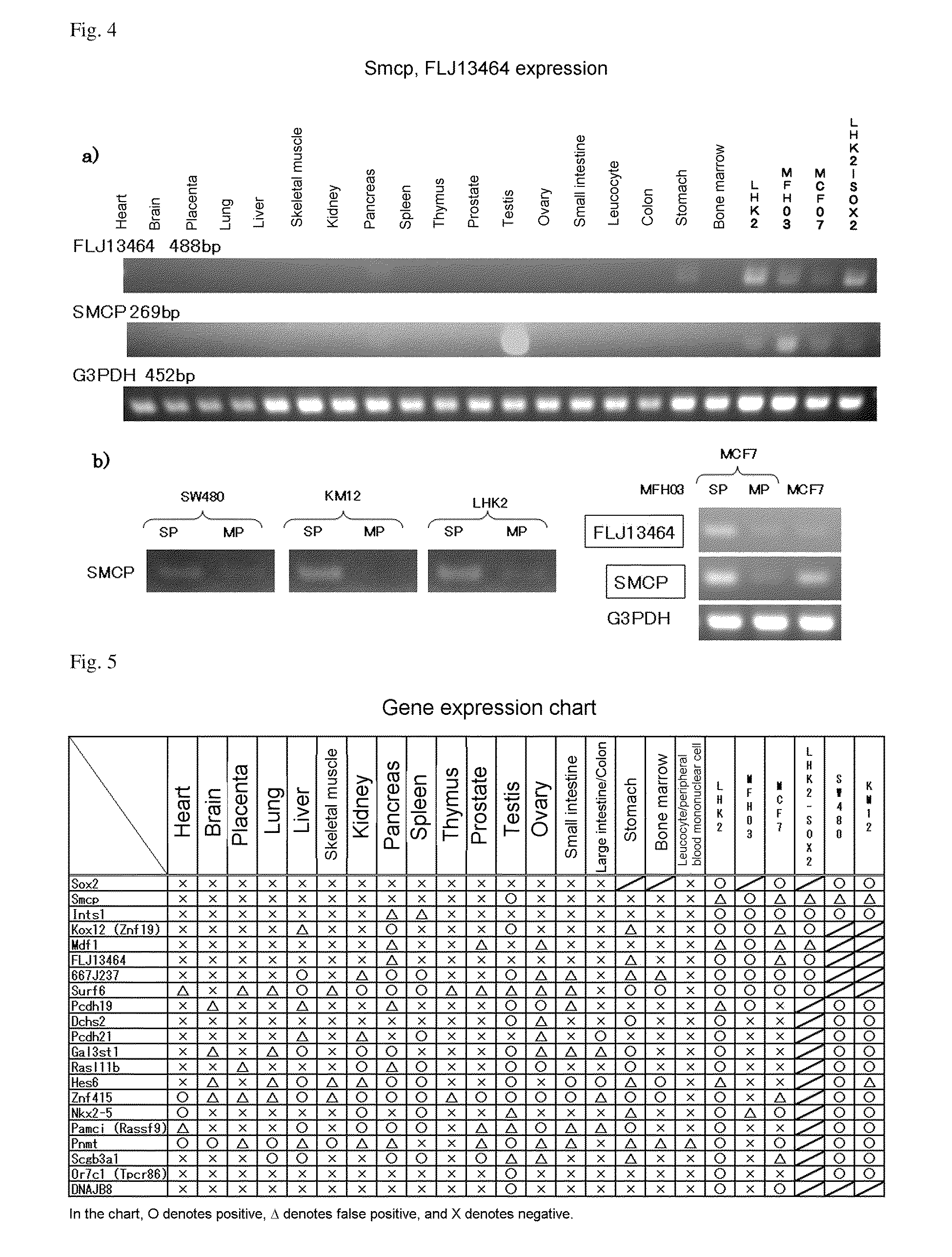 Molecular marker for cancer stem cell