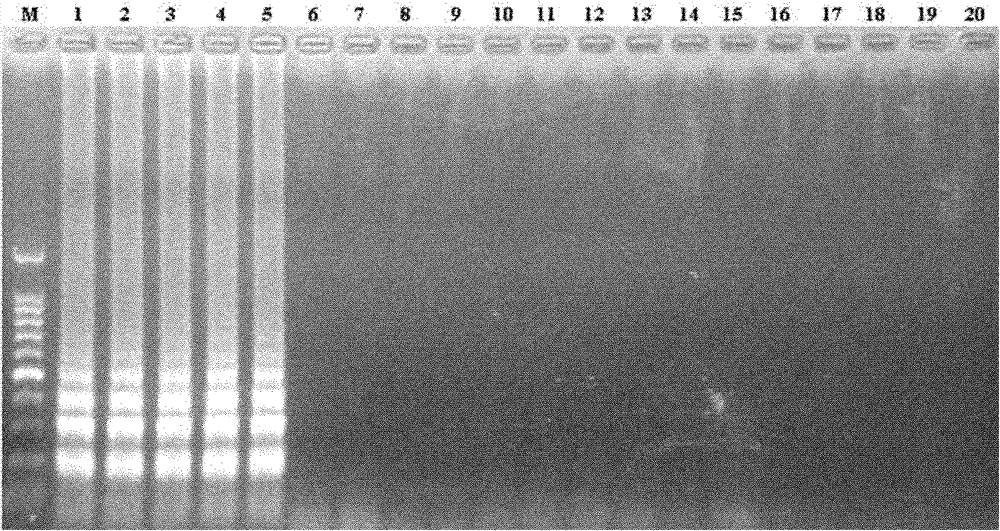 LAMP (Loop-mediated Isothermal Amplification) detection kit and method of pathogenic aeromonas hydrophila