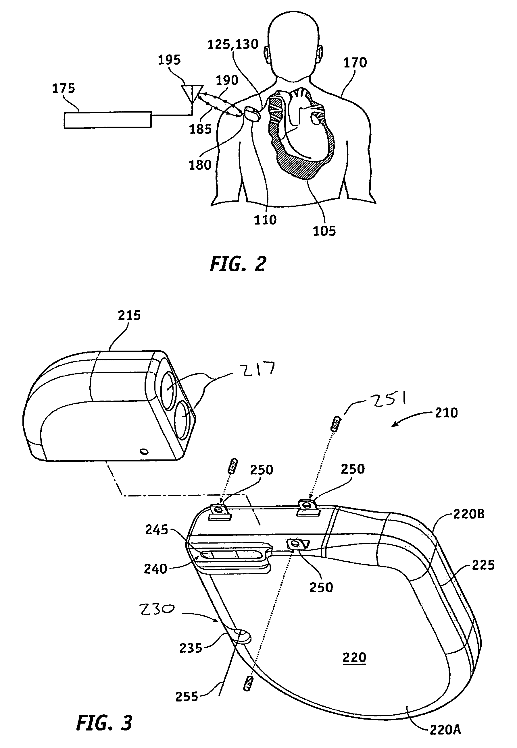 Radio frequency antenna flexible circuit interconnect with unique micro connectors