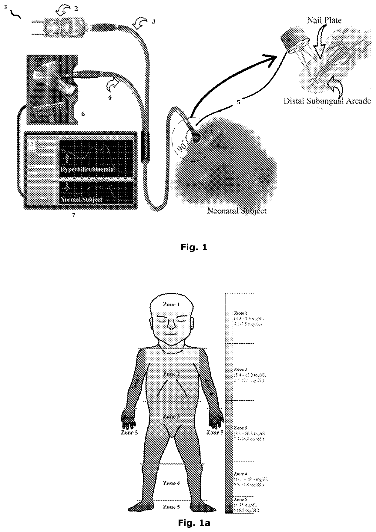 Non invasive screening system for neonatal hyperbilirubinemia