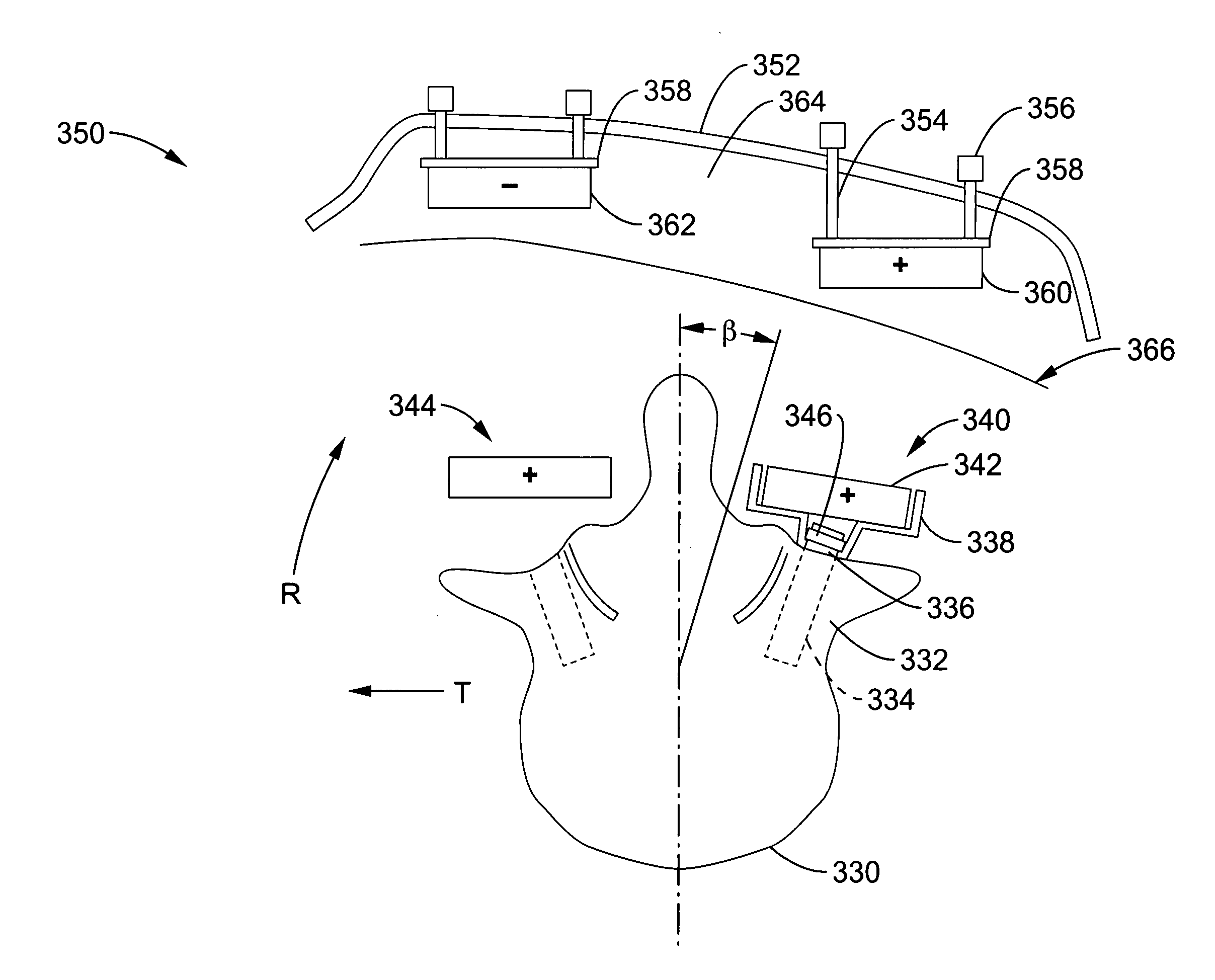 Apparatus and methods for magnetic alteration of deformities