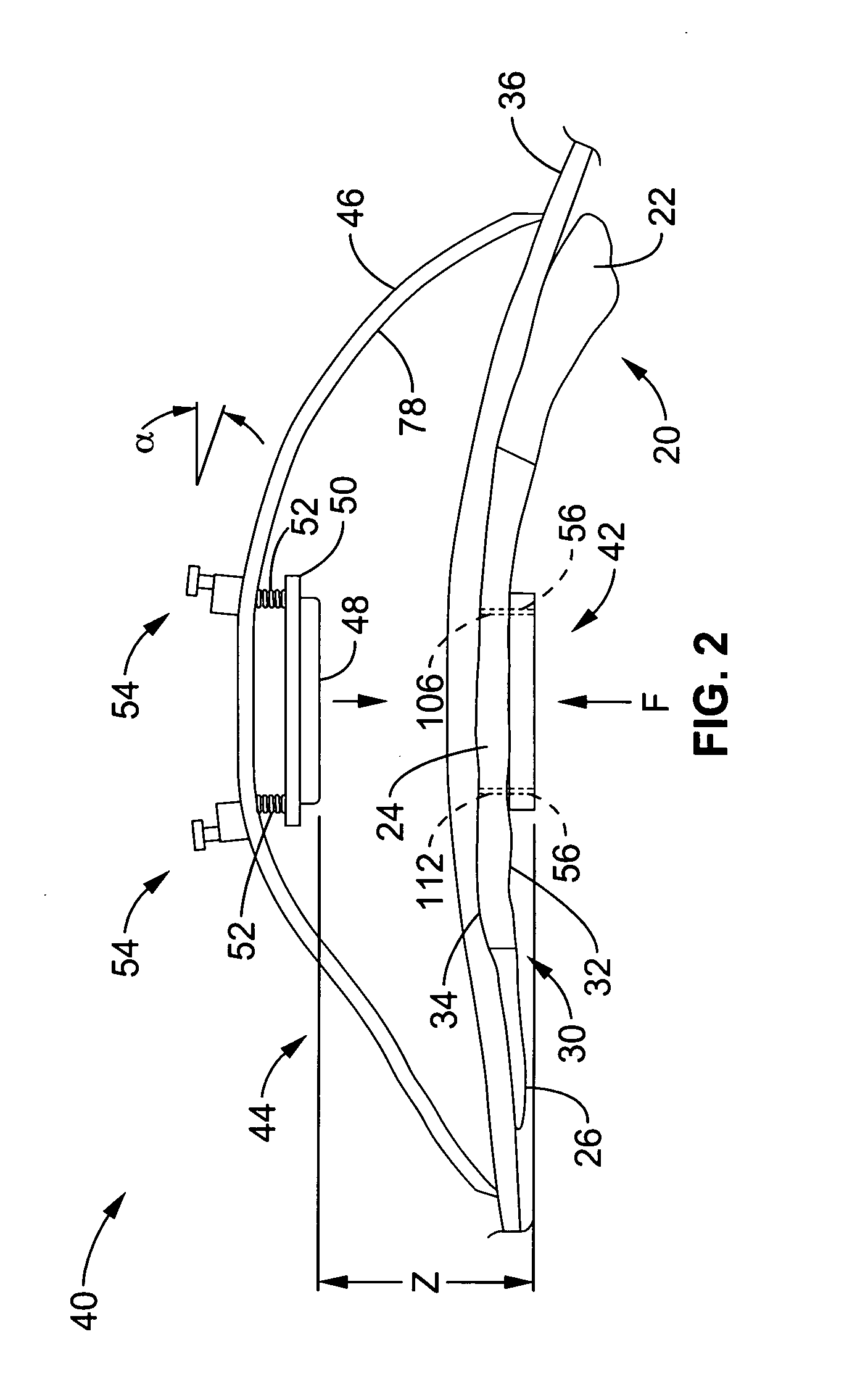 Apparatus and methods for magnetic alteration of deformities