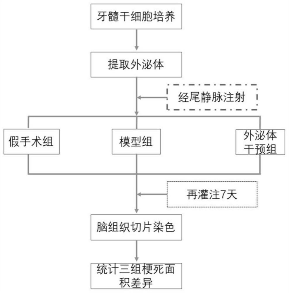 Method for treating cerebral ischemia-reperfusion injury by using dental pulp stem cell exosome