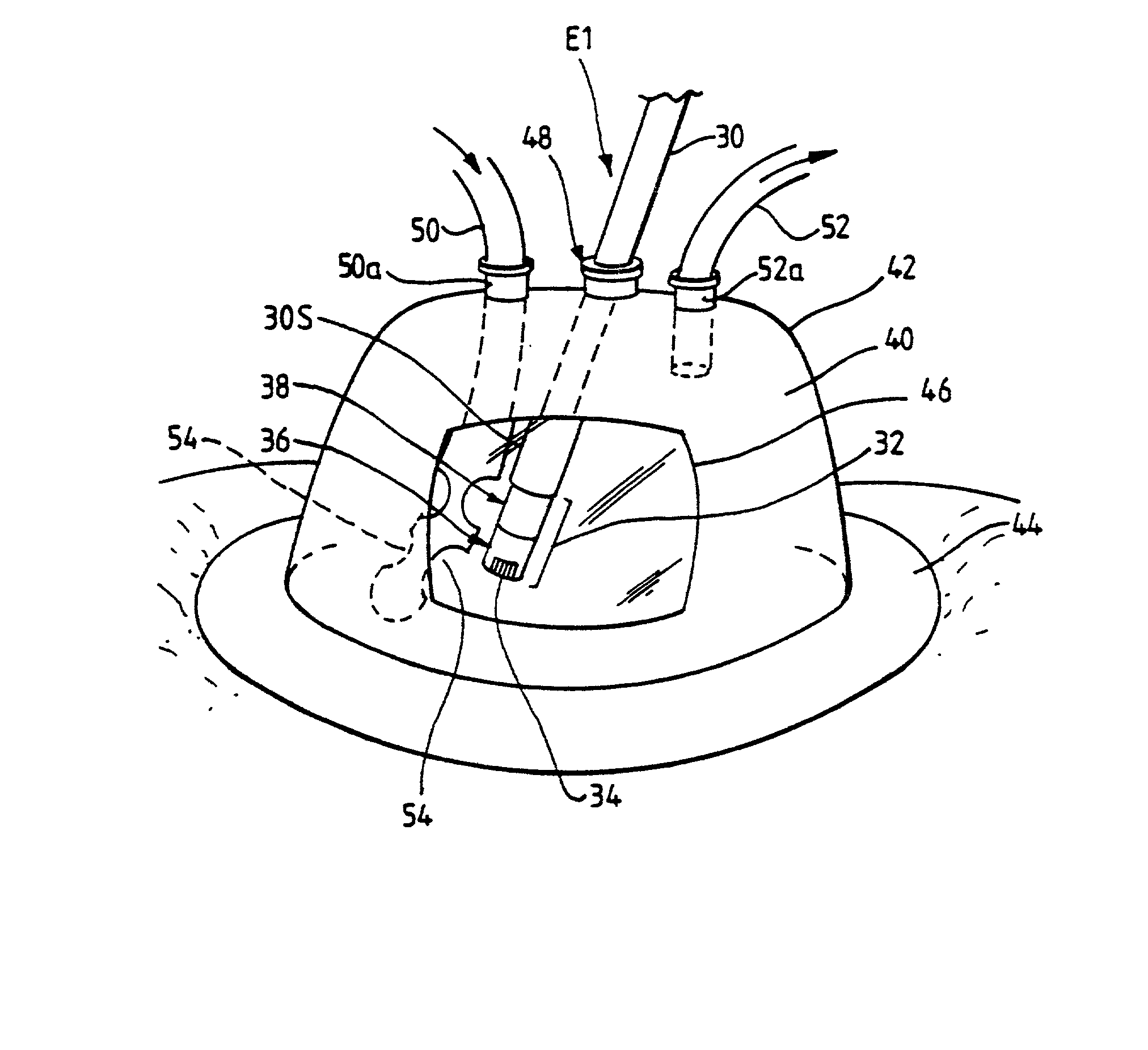 Electrosurgical system and method