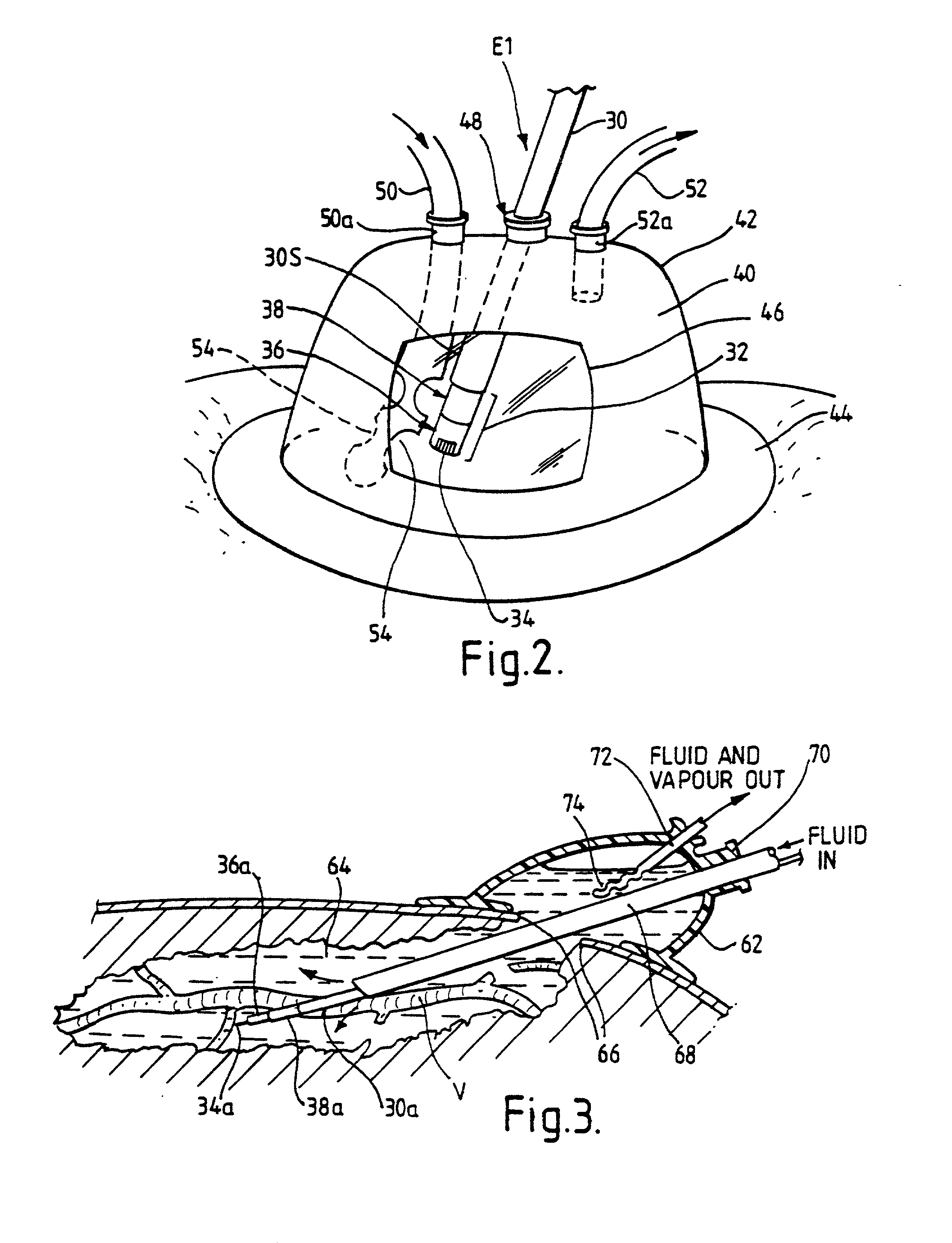 Electrosurgical system and method