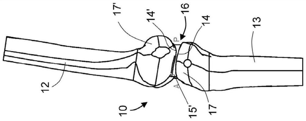 Joint spacer