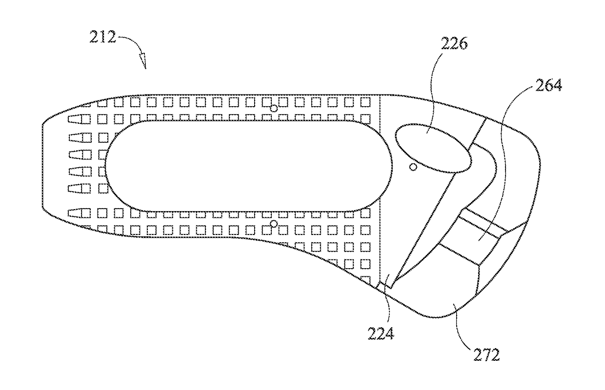 Spinal implant system and method