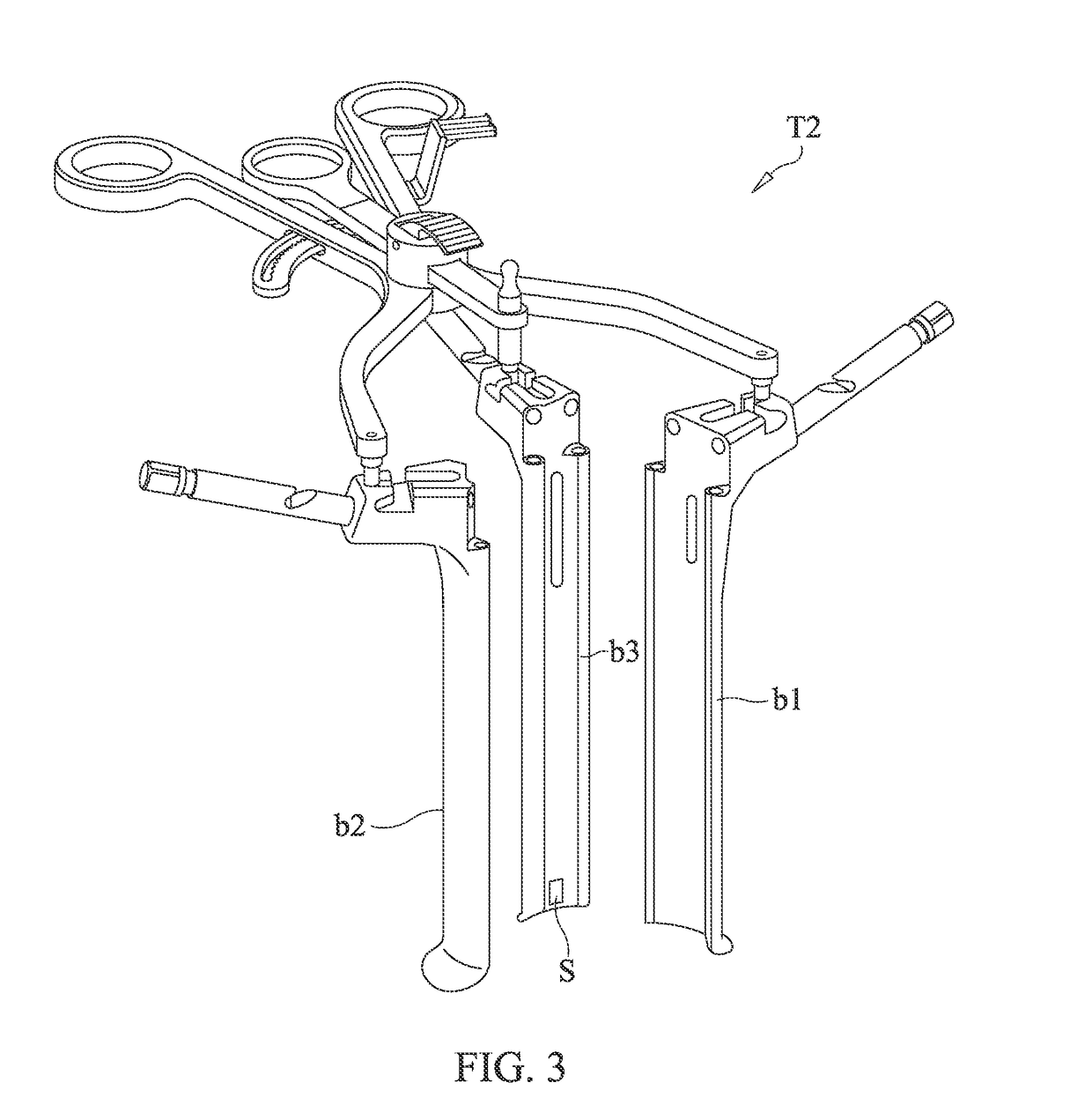 Spinal implant system and method