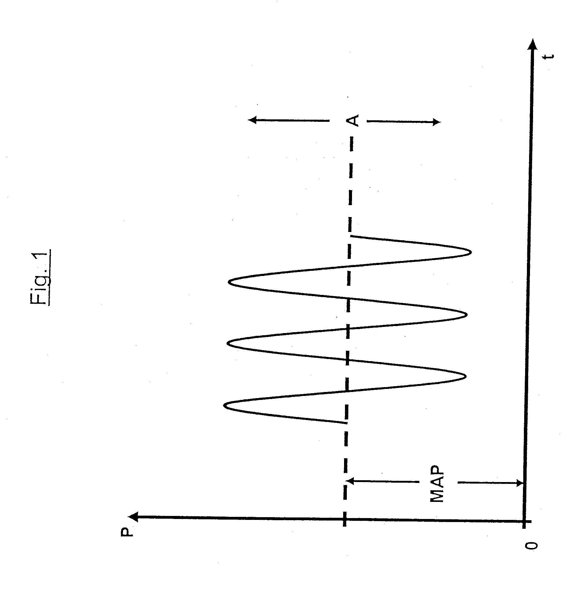 Device and method for respirating a patient by means of high-frequency ventilation