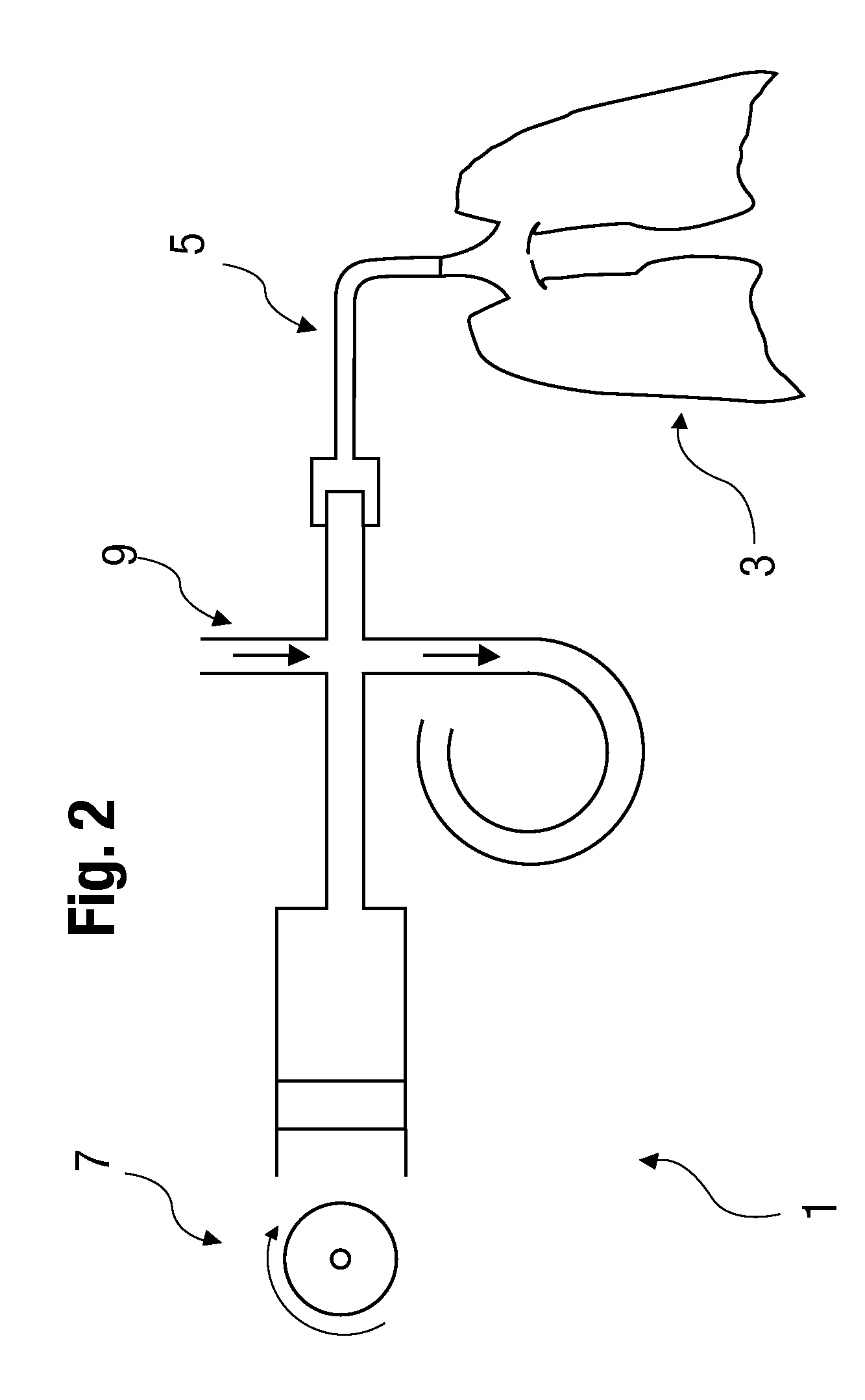 Device and method for respirating a patient by means of high-frequency ventilation