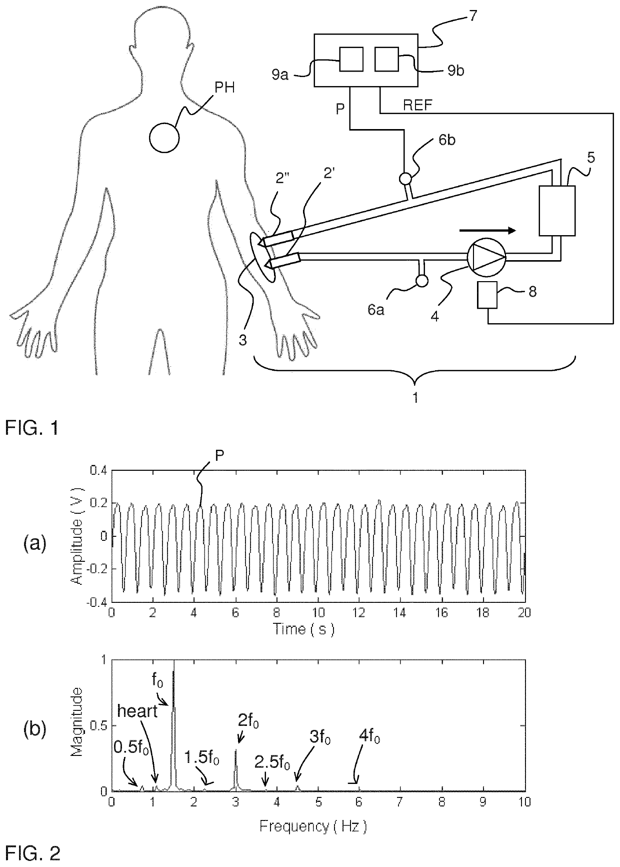 Filtering of pressure signals for suppression of periodic pulses