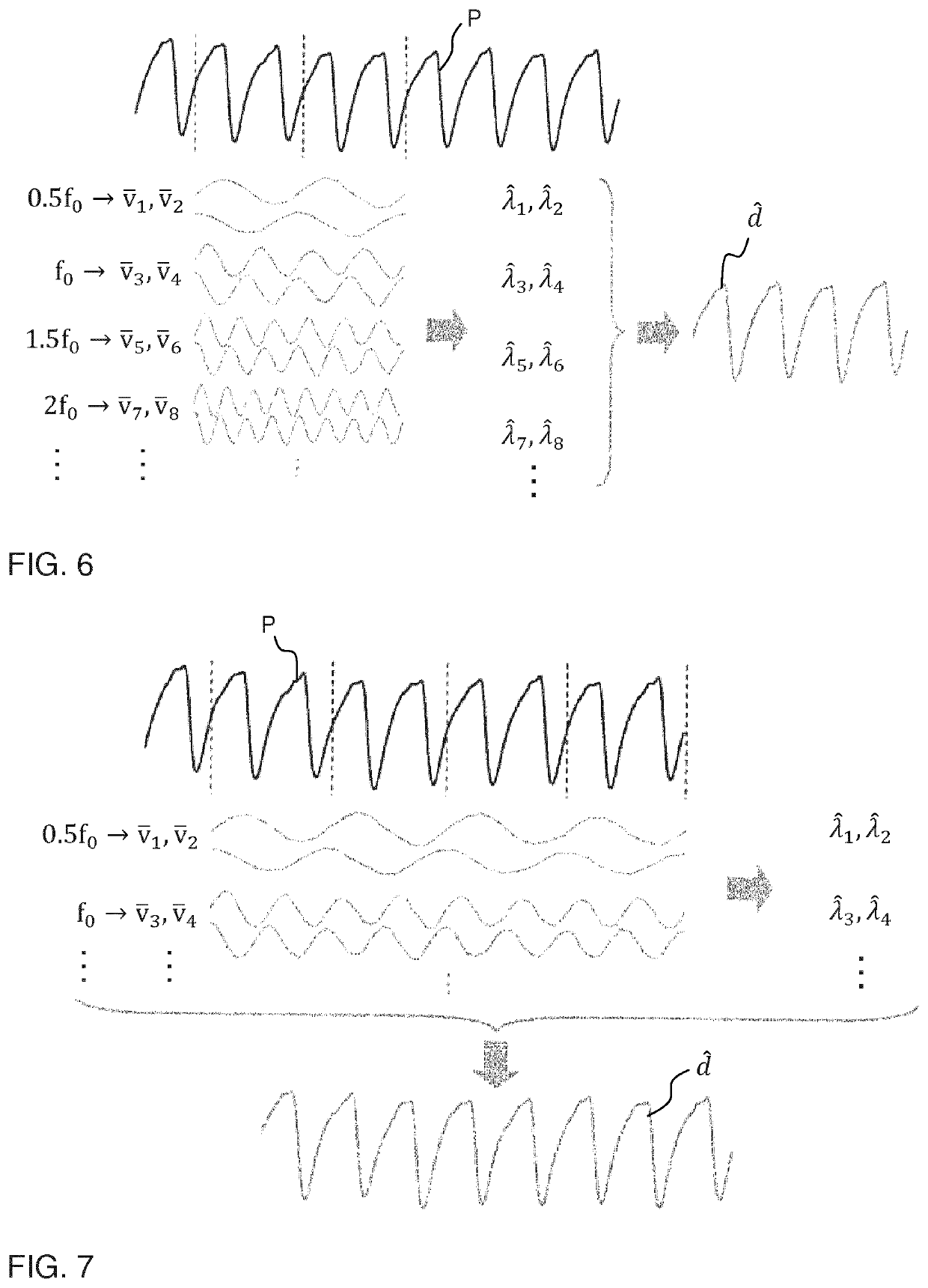 Filtering of pressure signals for suppression of periodic pulses