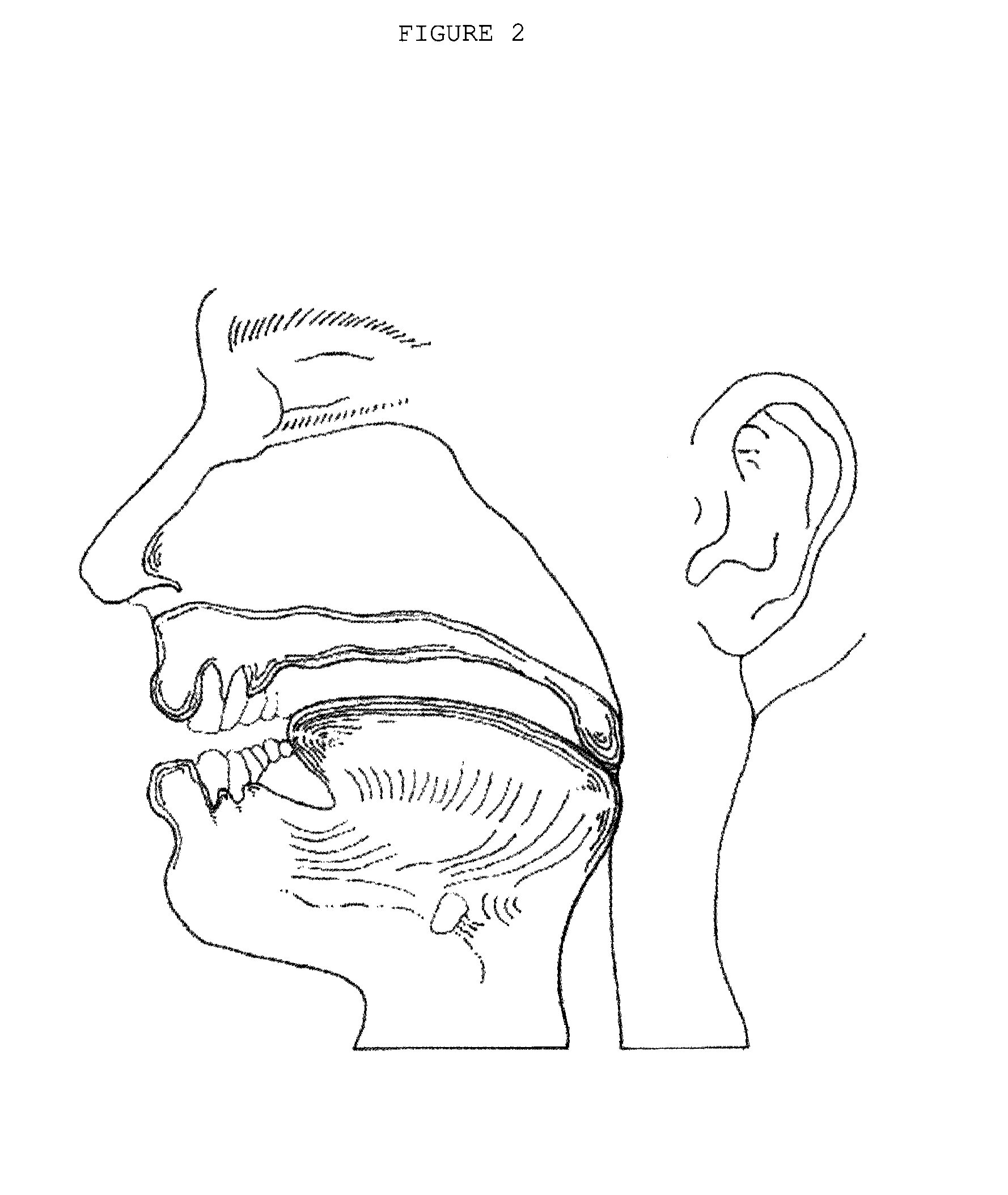 Integrated oral appliance for sleep-disordered breathing