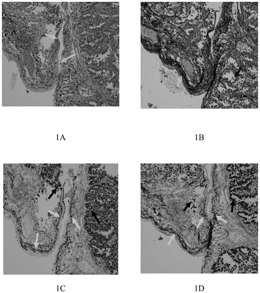 Rich double-staining kit and use method thereof