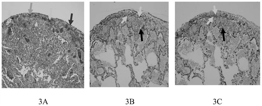 Rich double-staining kit and use method thereof