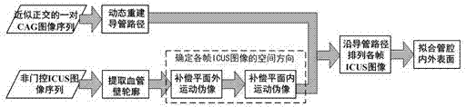 Vascular four-dimensional reconstruction method in NOT gate-controlled ICUS (intravascular ultrasound) image sequence