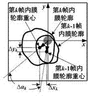 Vascular four-dimensional reconstruction method in NOT gate-controlled ICUS (intravascular ultrasound) image sequence