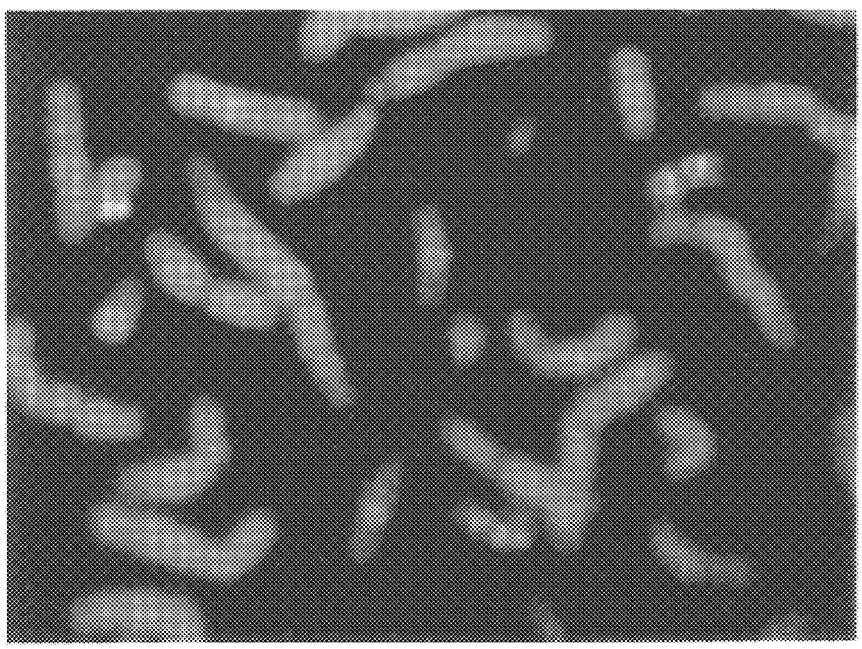 Comparative genomic hybridization (CGH)