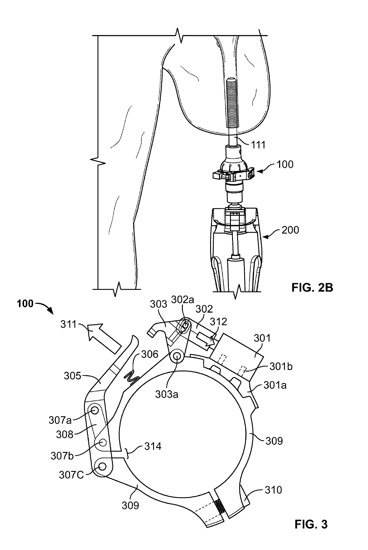 Safety overload for direct skeletal attachment