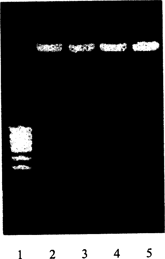 Fusion protein of human thymosin alpha1 and human composite interferon and preparation thereof