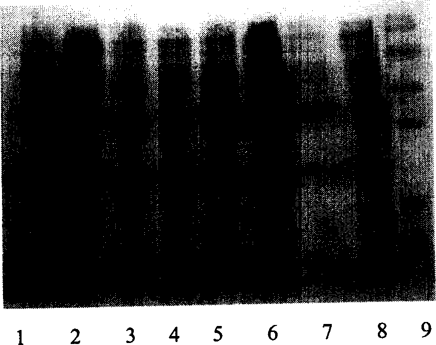 Fusion protein of human thymosin alpha1 and human composite interferon and preparation thereof