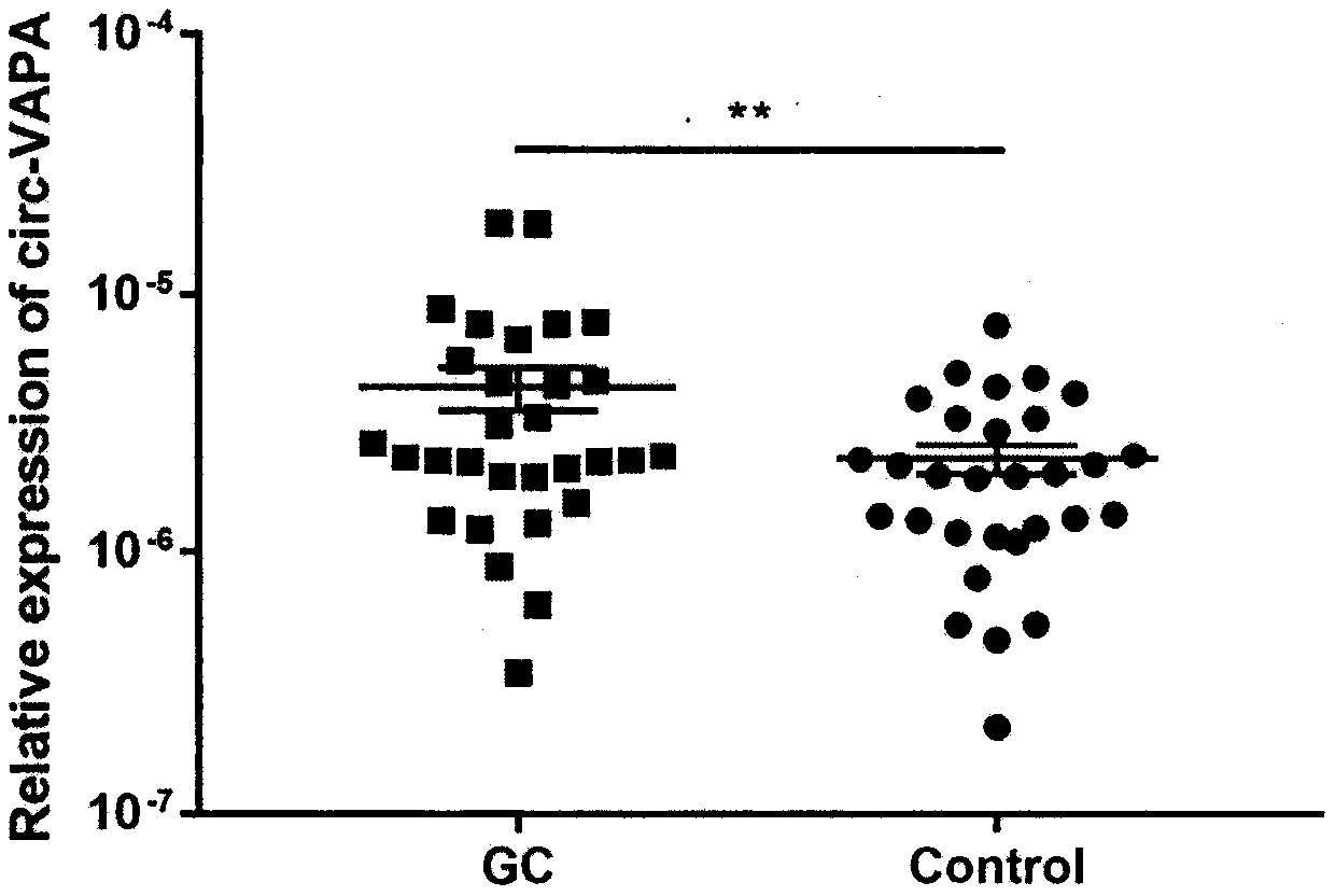 Application of circ-VAPA as gastric cancer and colorectal cancer diagnosis biomarker and treatment target point