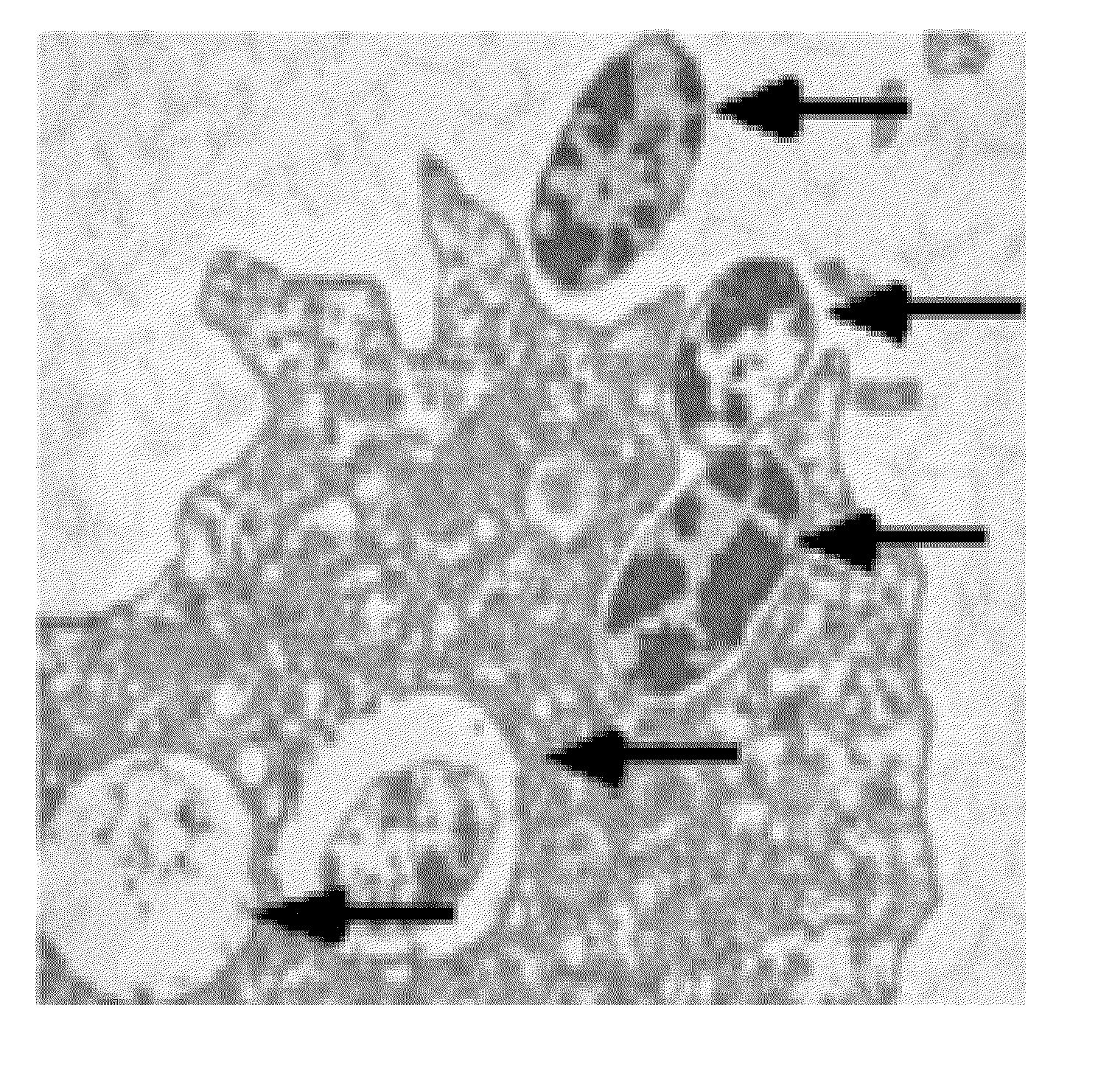 Therapeutic amoeba and uses thereof