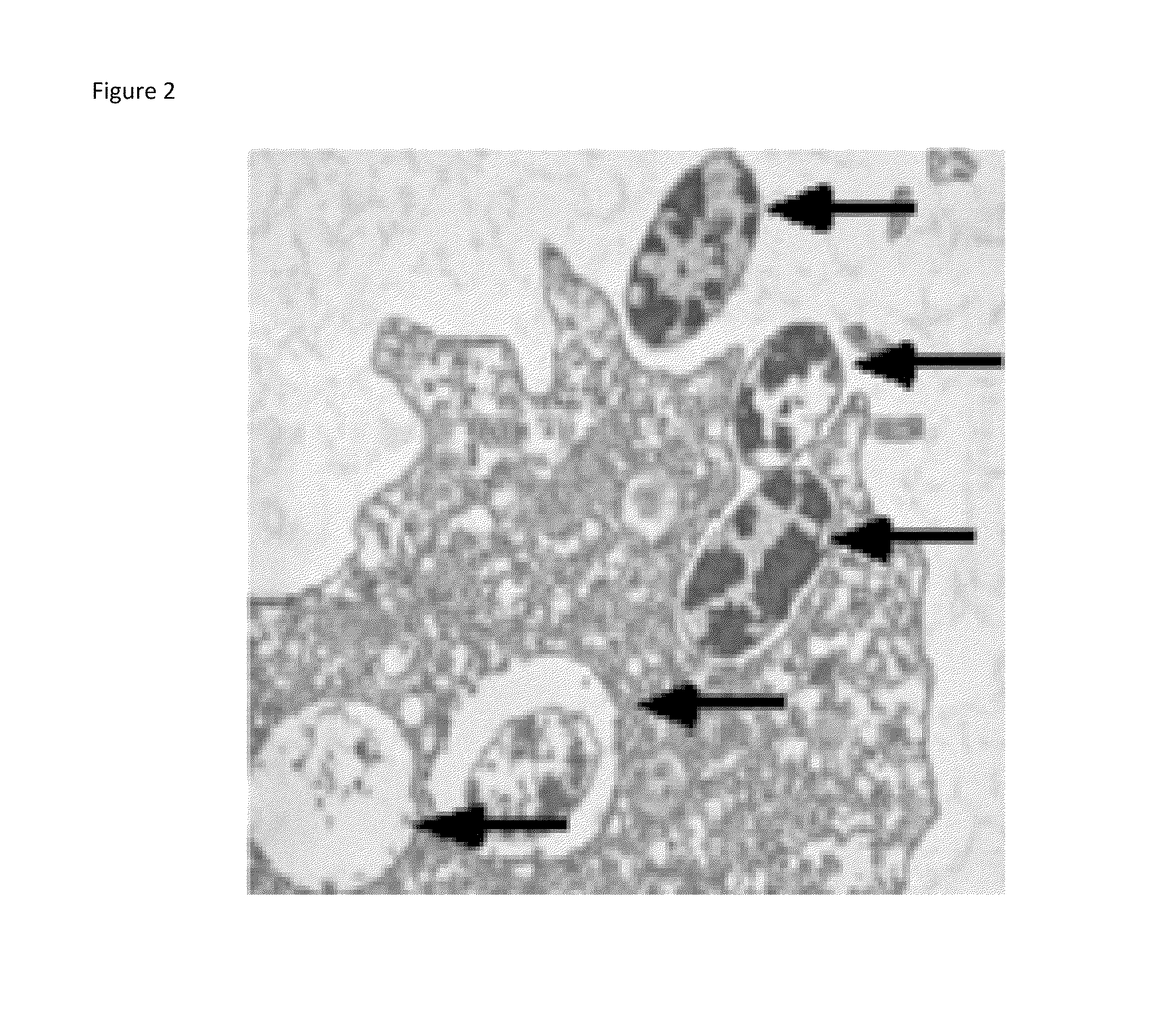 Therapeutic amoeba and uses thereof