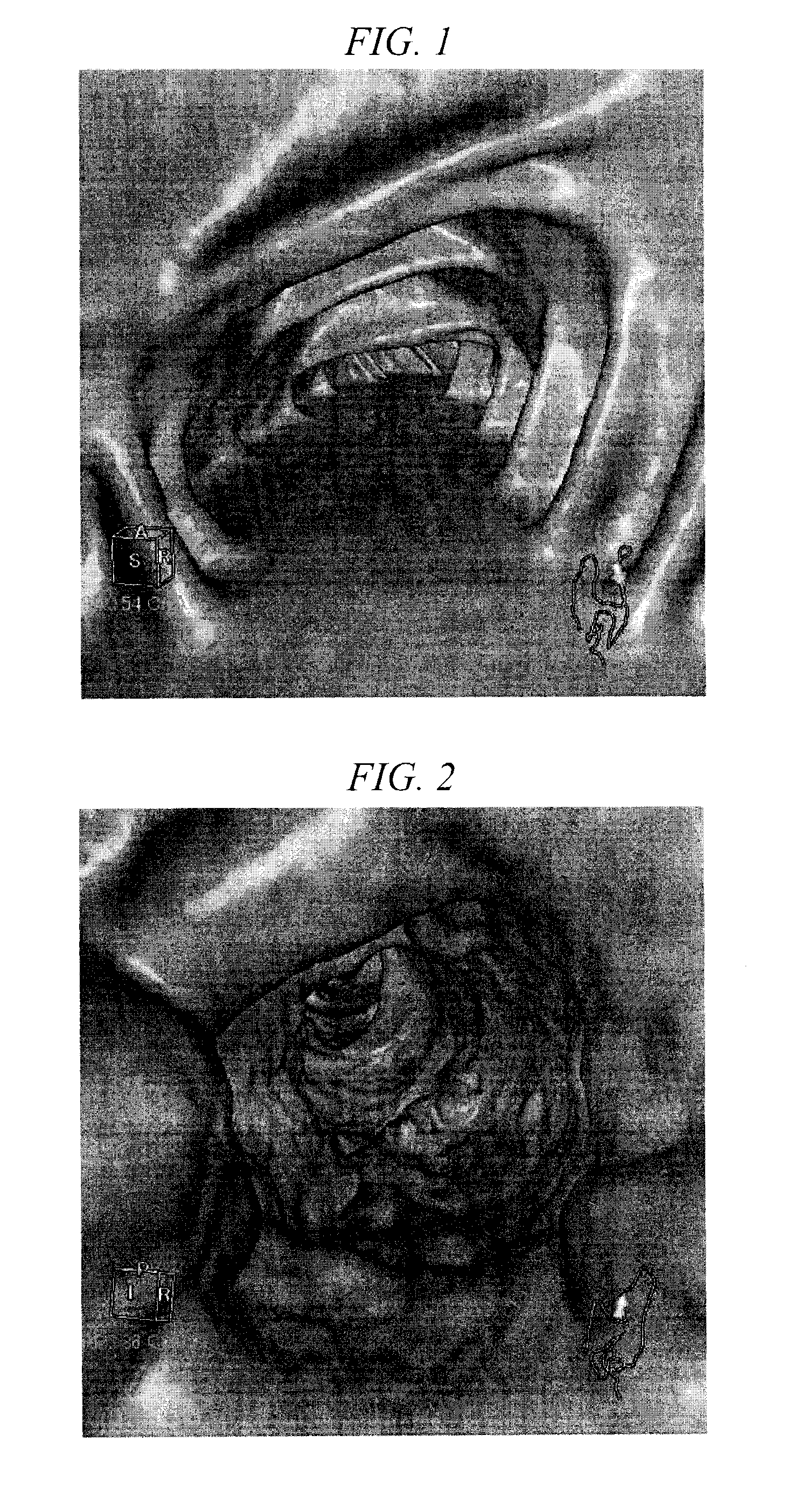 Liquid preparation for oral administration used for ct colonography and composition for gastrointestinal radiography