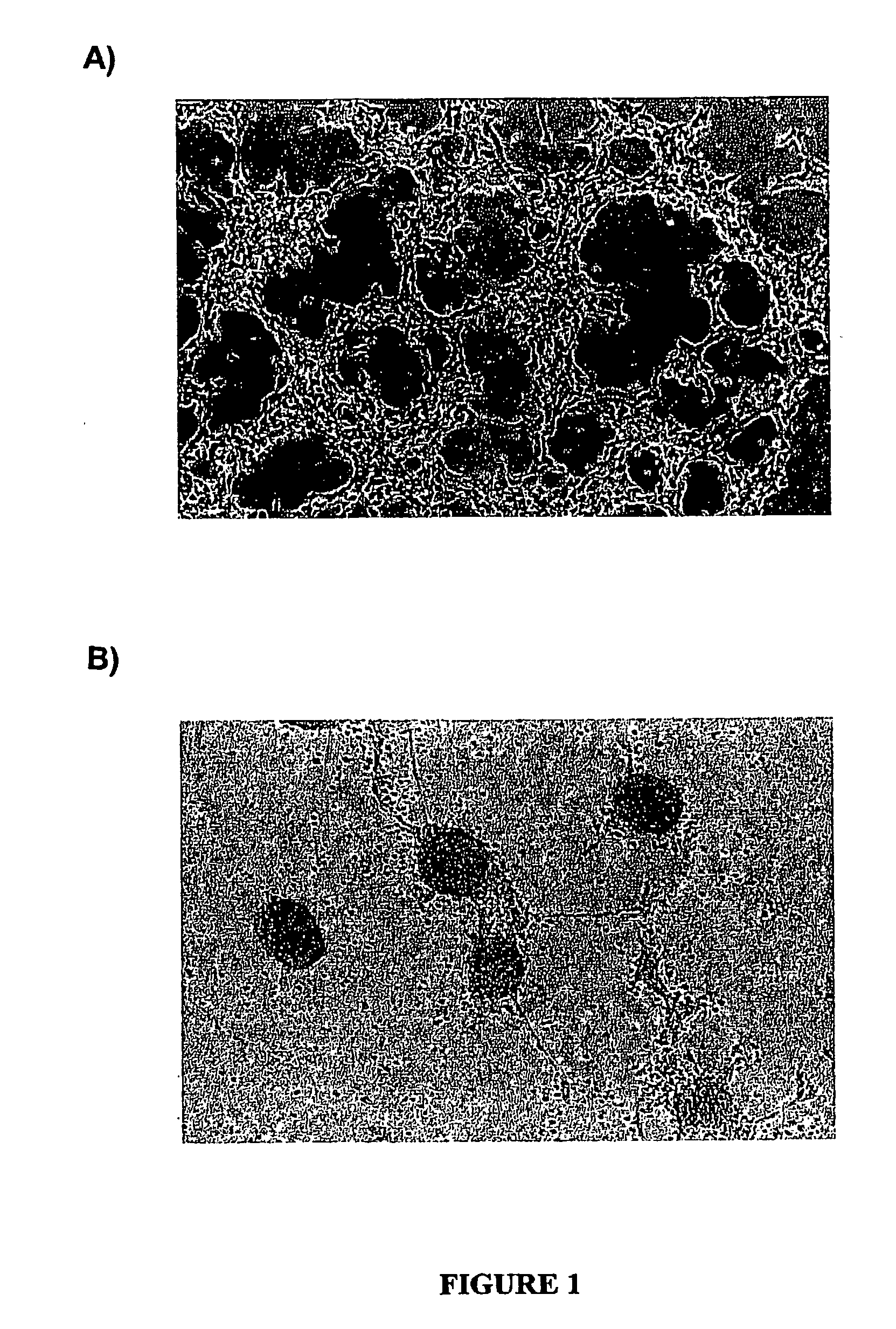 Ceruloplasmin and uses thereof in neurodegenerative related conditions