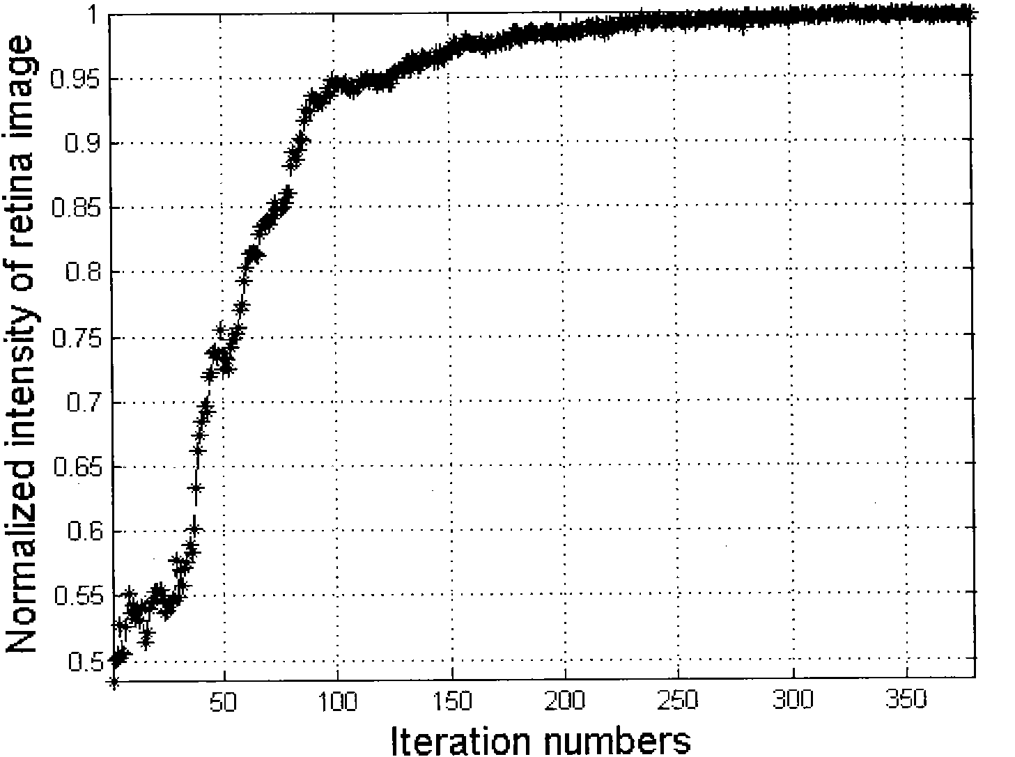 Aberration compensation fundus microscope based on automatic optimization algorithm