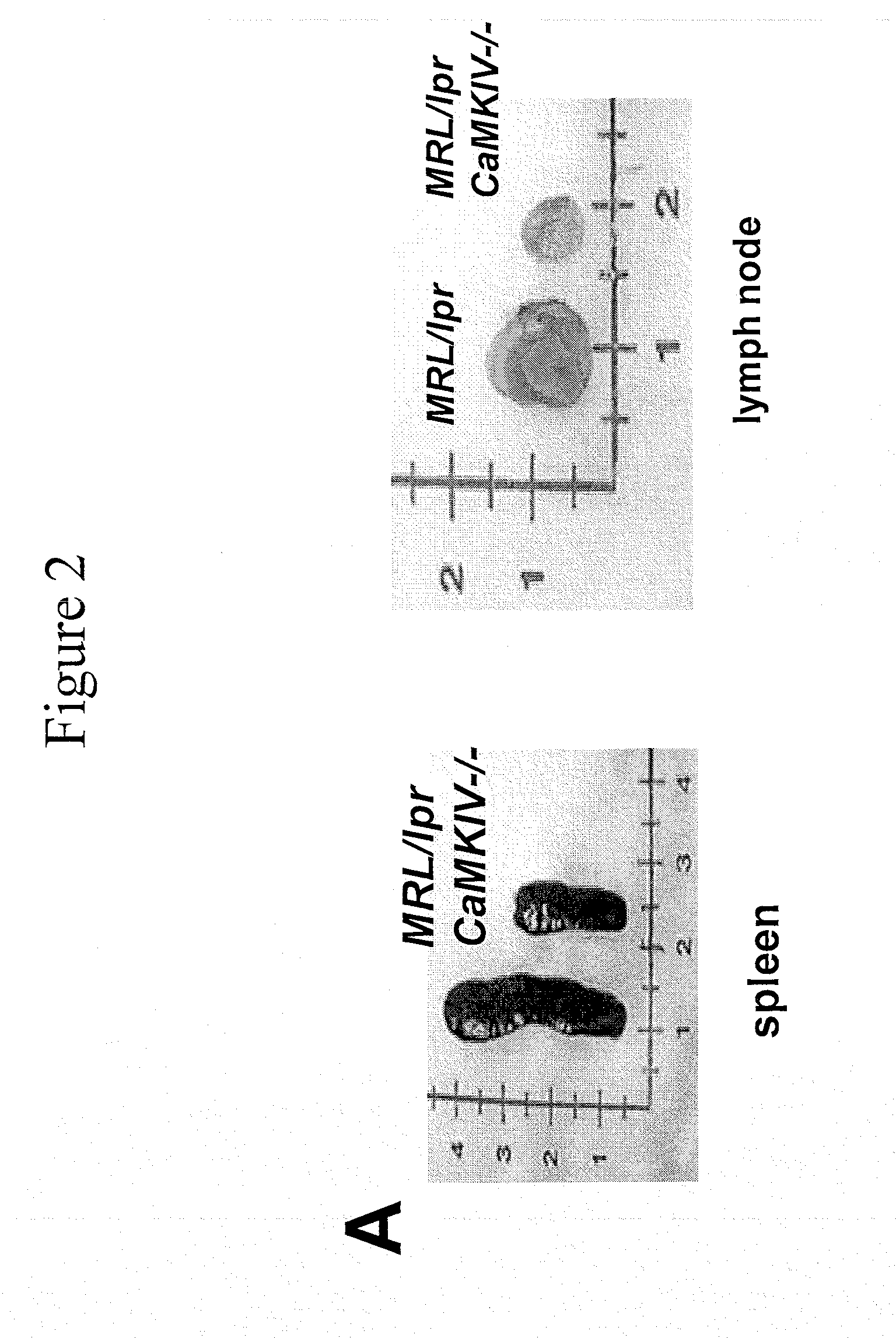 Methods for treating inflammatory autoimmune disorders